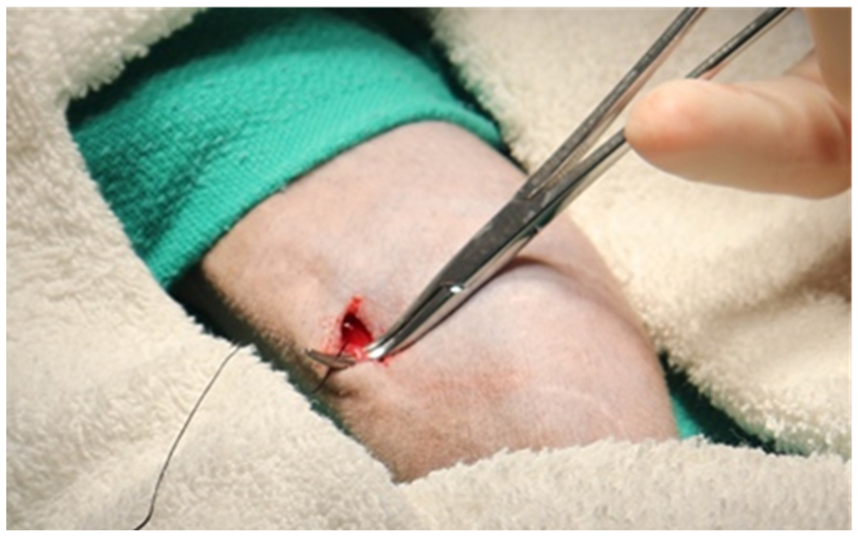 Surgeries 04 00044 g002