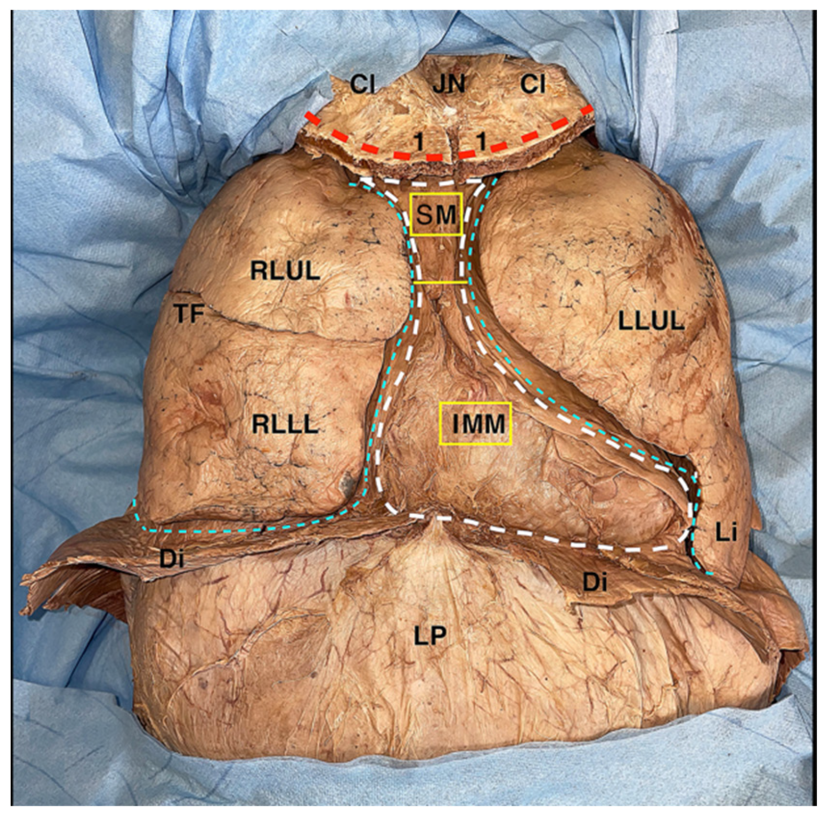 Surgeries 04 00046 g004