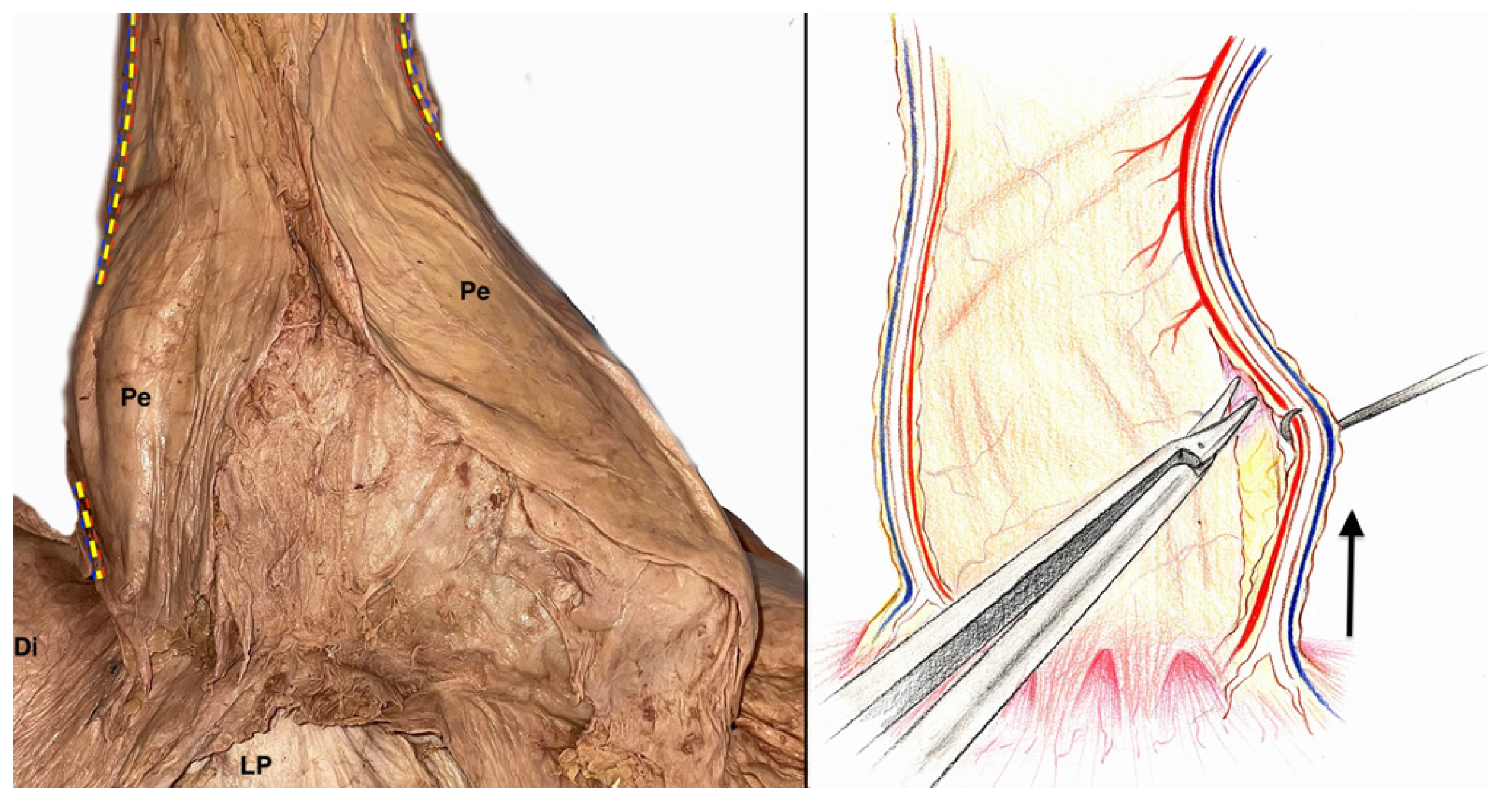 Surgeries 04 00046 g006
