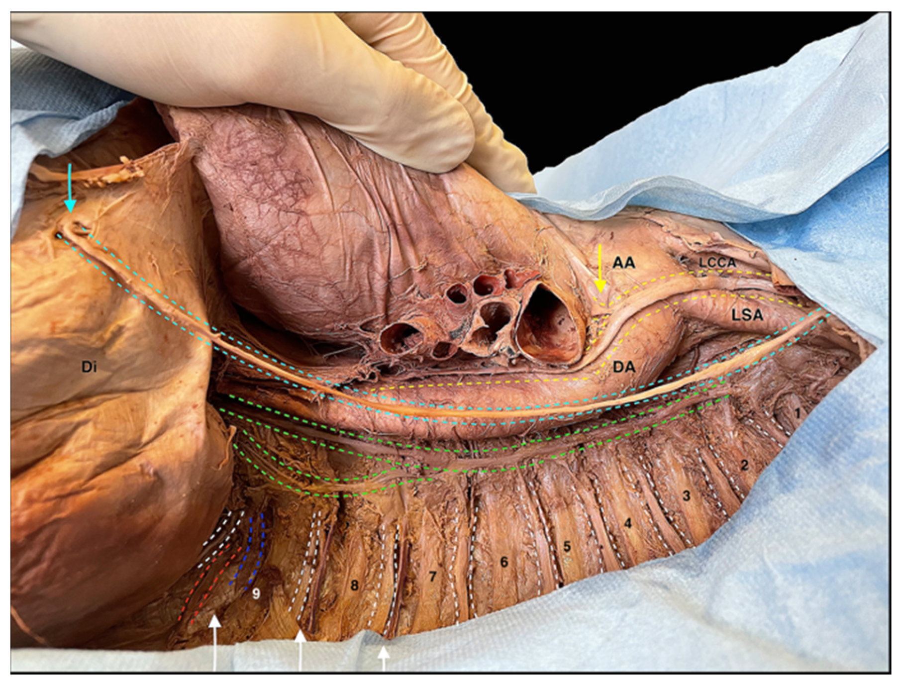 Surgeries 04 00046 g009