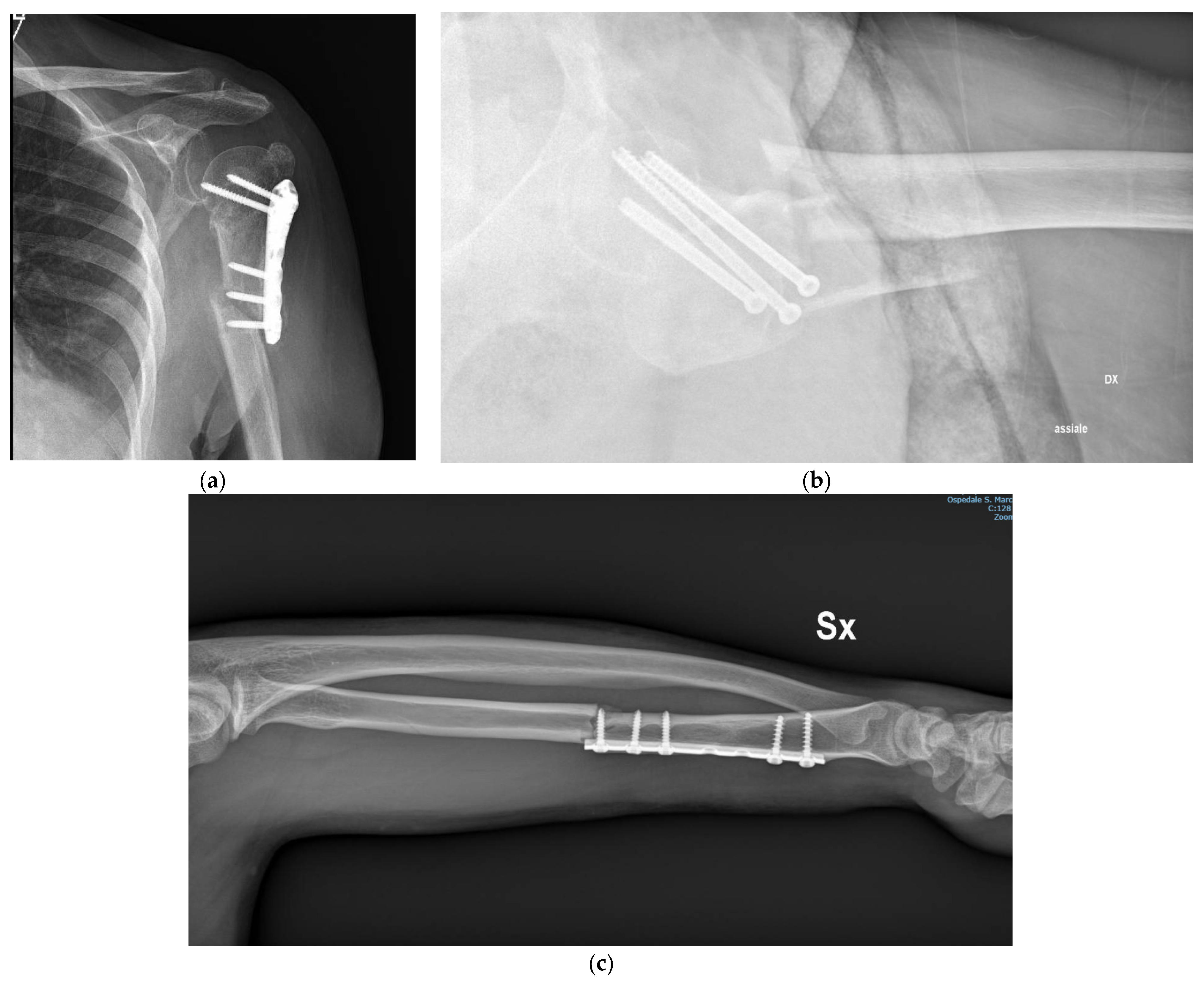 Surgeries 04 00052 g005