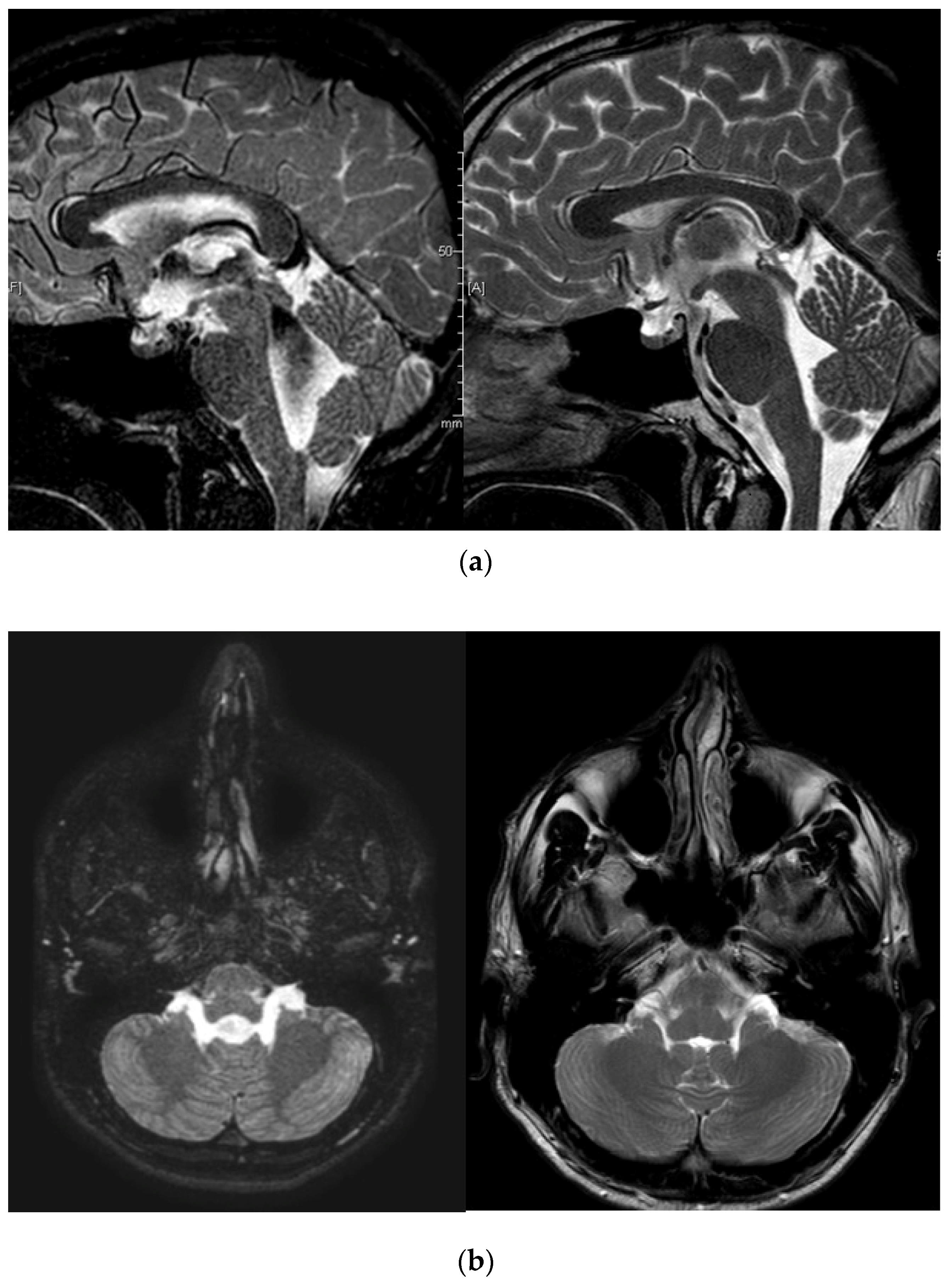 Surgeries 04 00063 g002