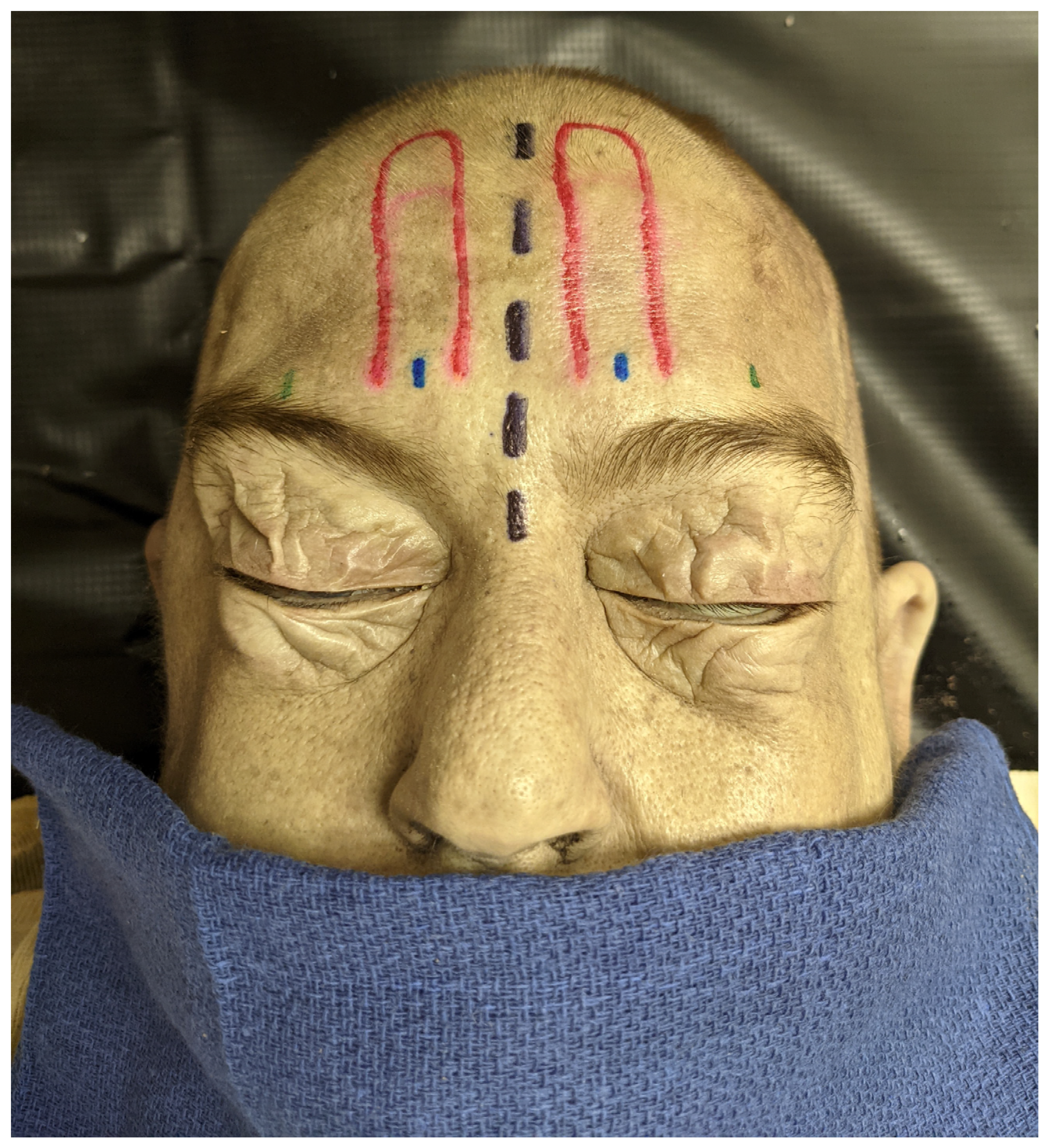 Surgeries 05 00004 g002