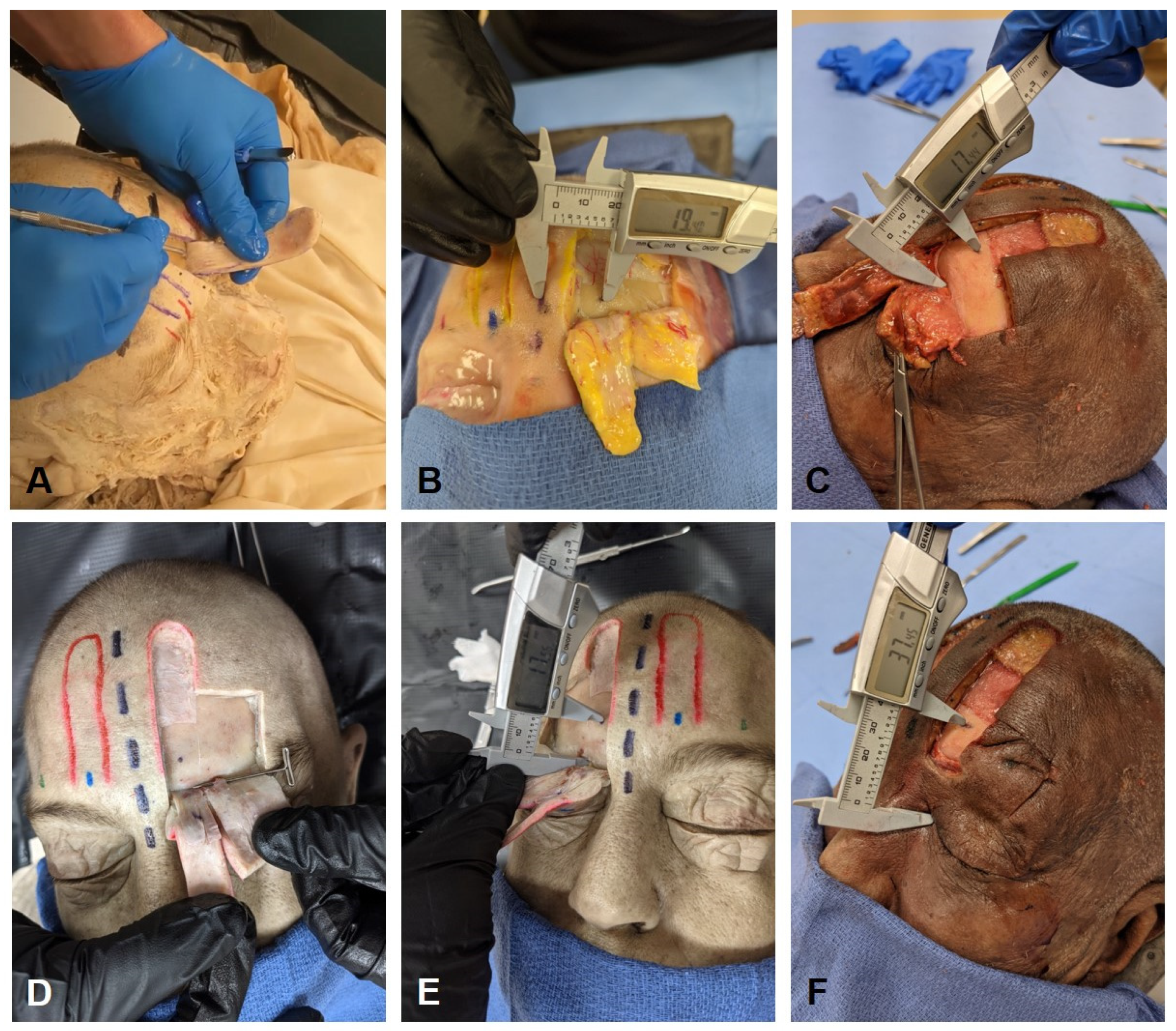 Surgeries 05 00004 g003