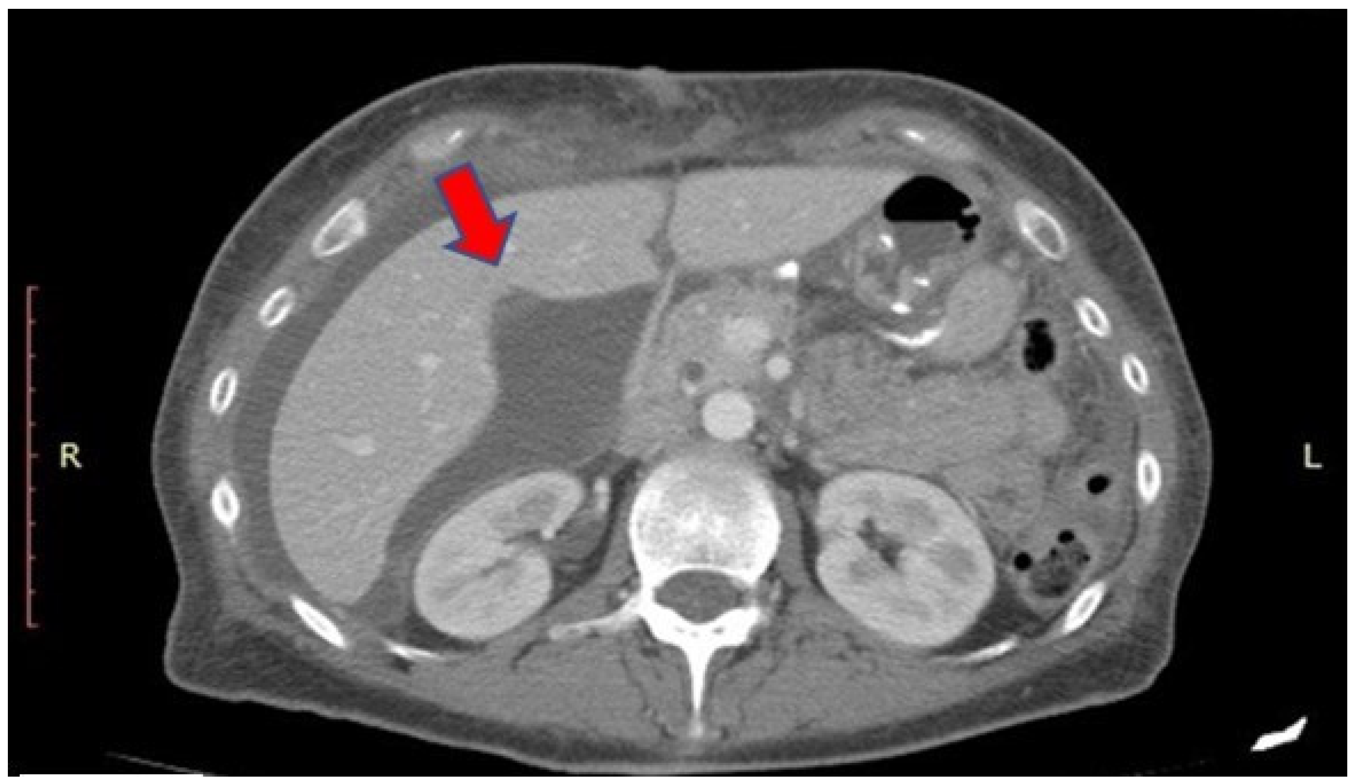 Surgeries 05 00008 g004 Surgeries 05 00008 g004
