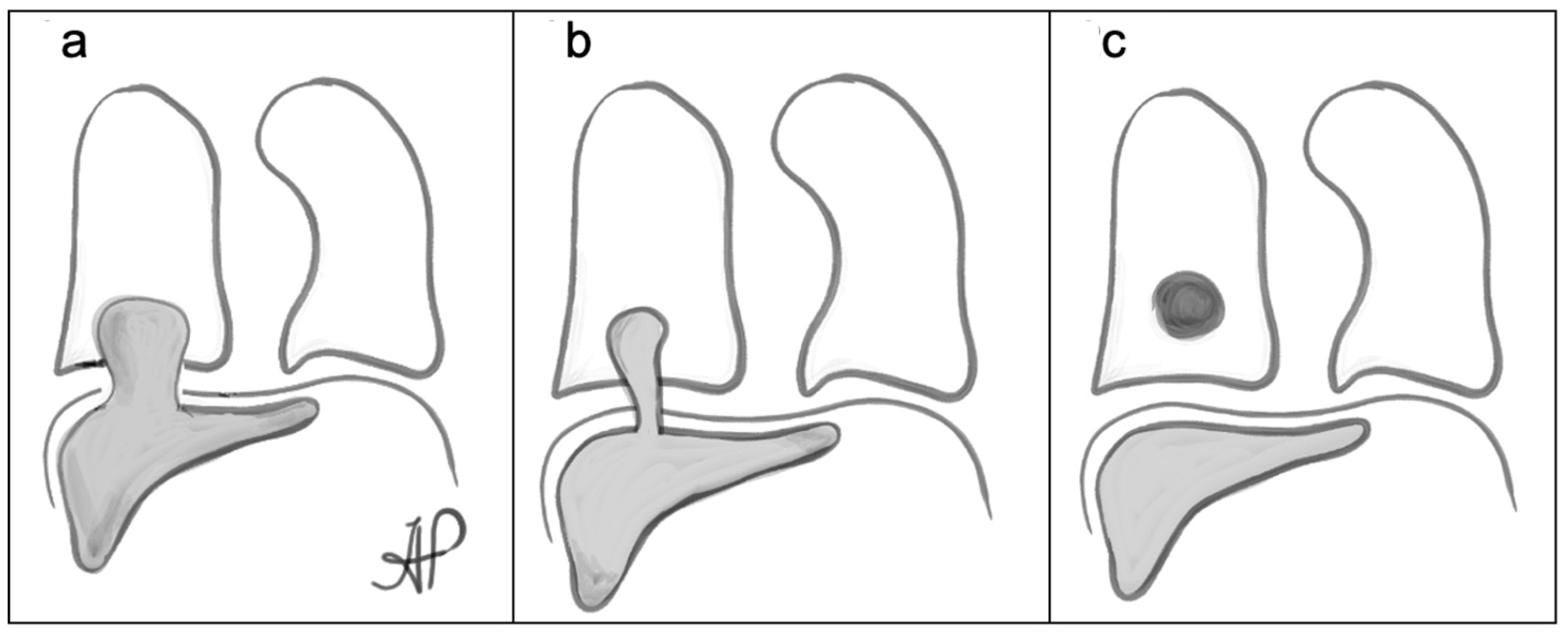 Surgeries 05 00010 g002