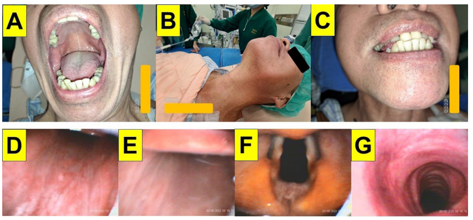 Surgeries 05 00015 g006 Surgeries 05 00015 g006