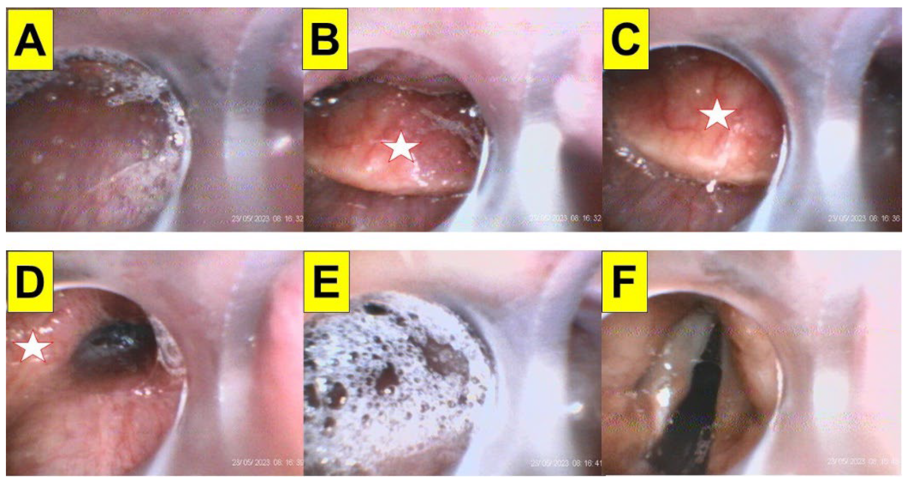 Surgeries 05 00015 g007 Surgeries 05 00015 g007
