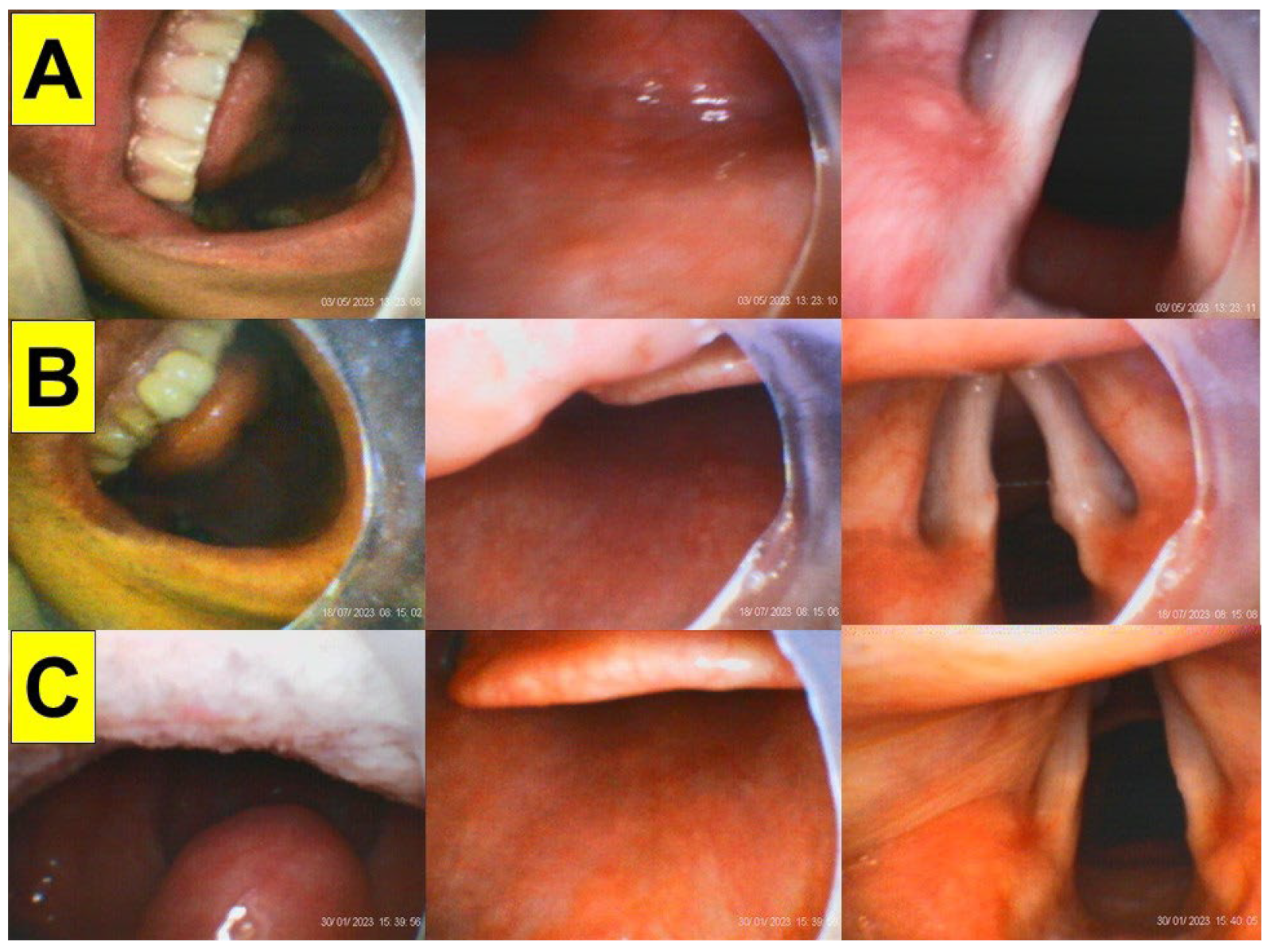 Surgeries 05 00015 g008 Surgeries 05 00015 g008