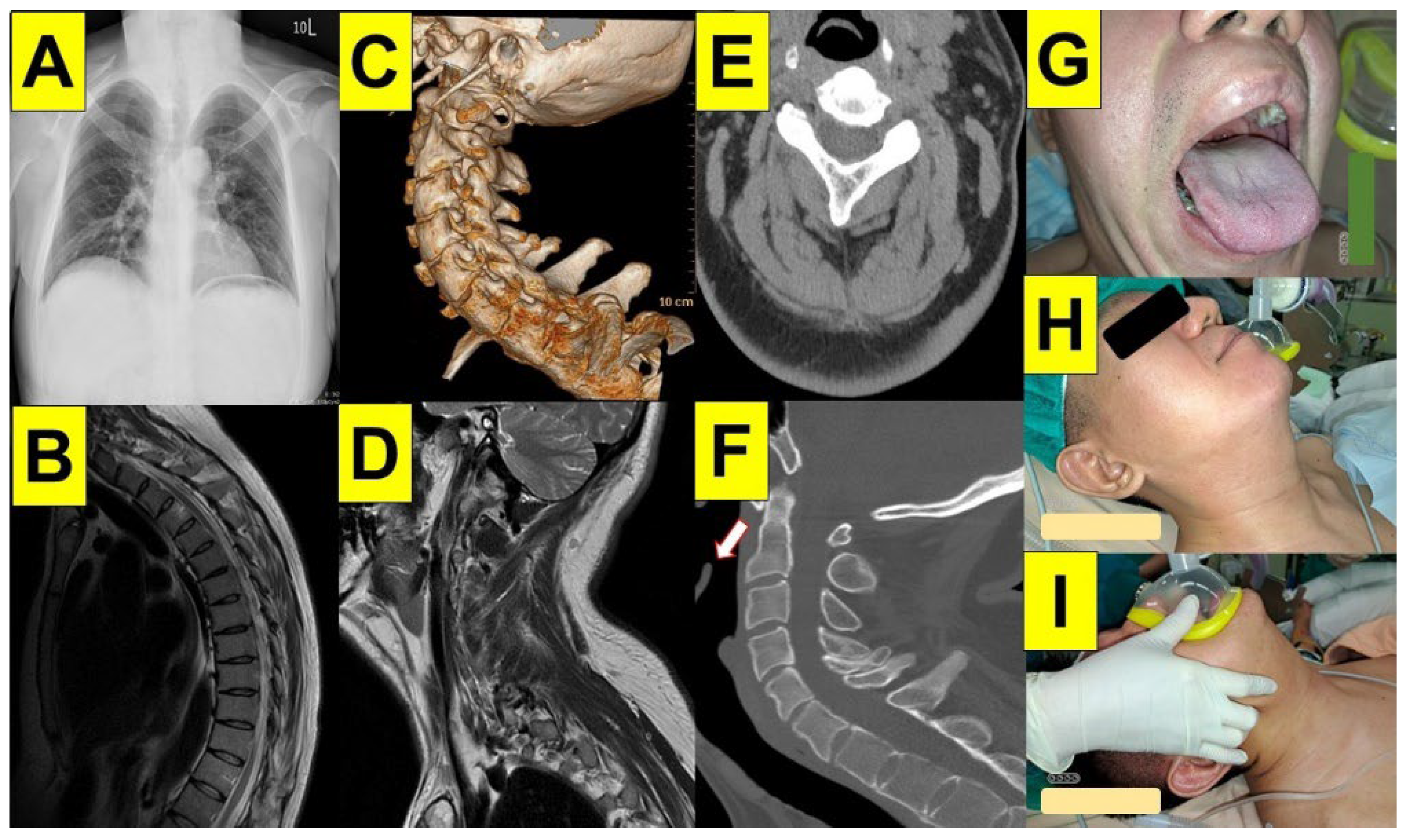 Surgeries 05 00015 g009 Surgeries 05 00015 g009