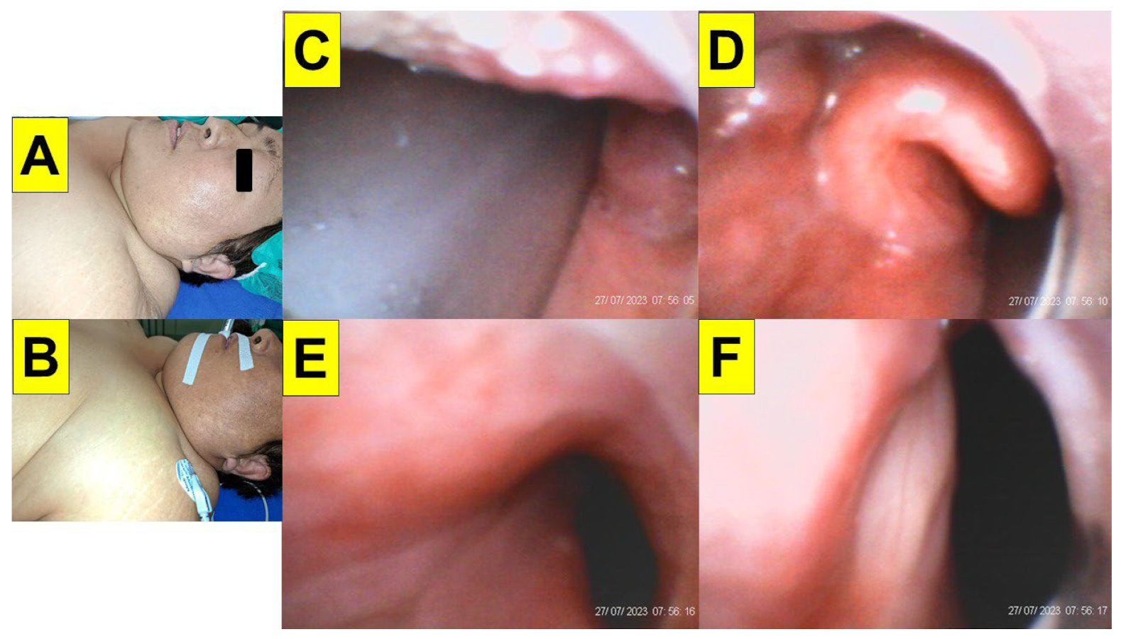 Surgeries 05 00015 g011 Surgeries 05 00015 g011