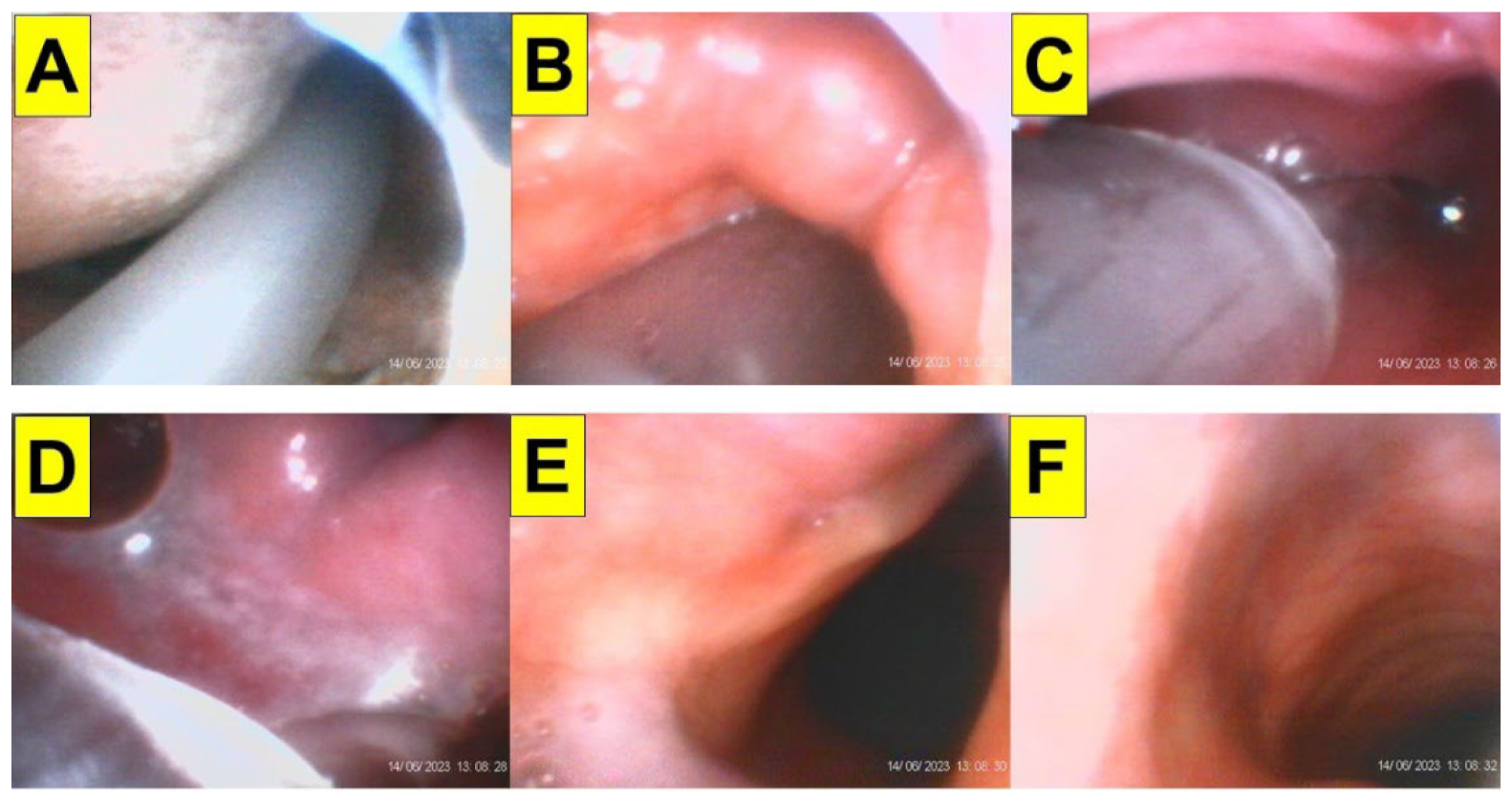 Surgeries 05 00015 g012 Surgeries 05 00015 g012