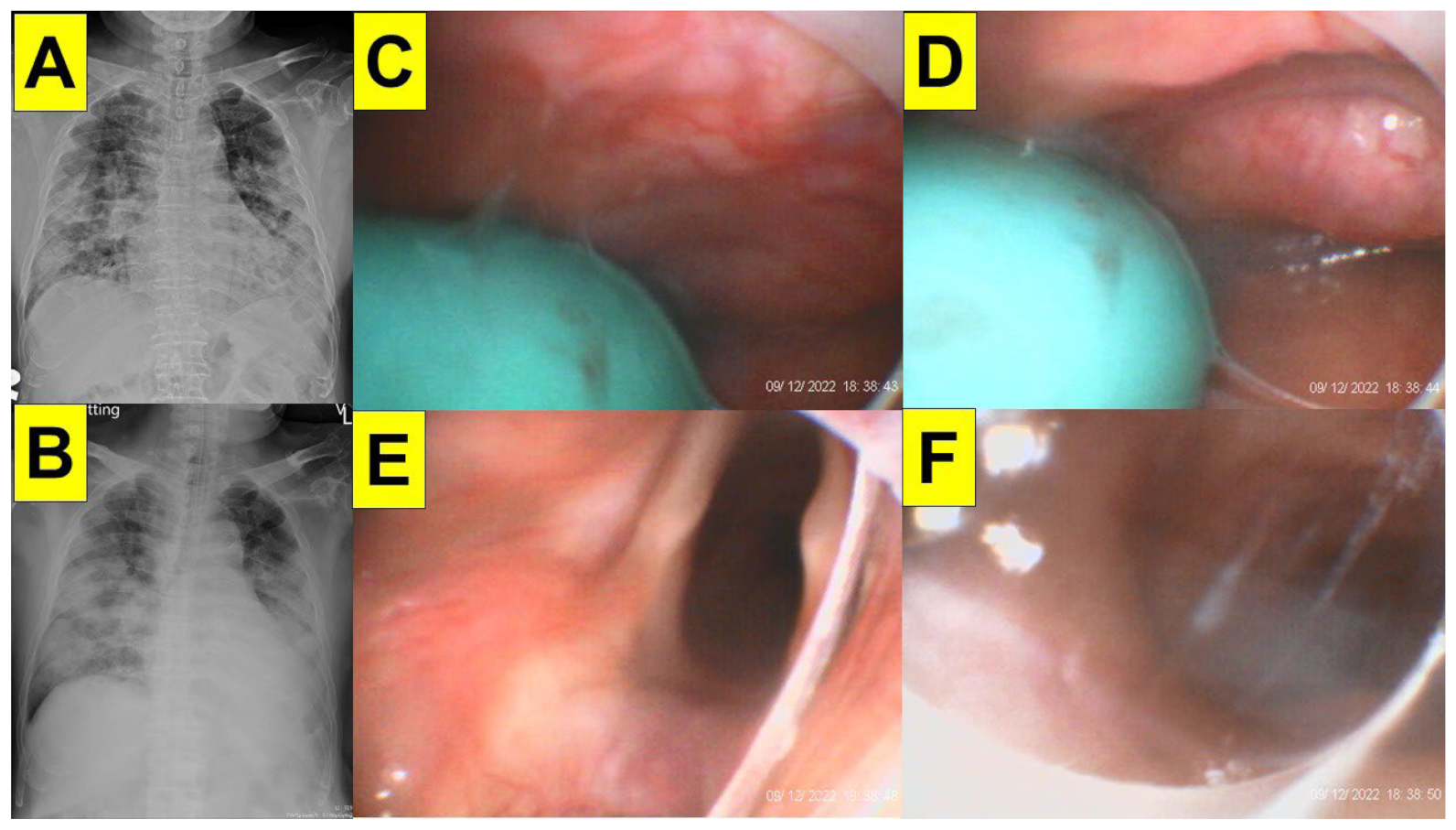 Surgeries 05 00015 g013 Surgeries 05 00015 g013