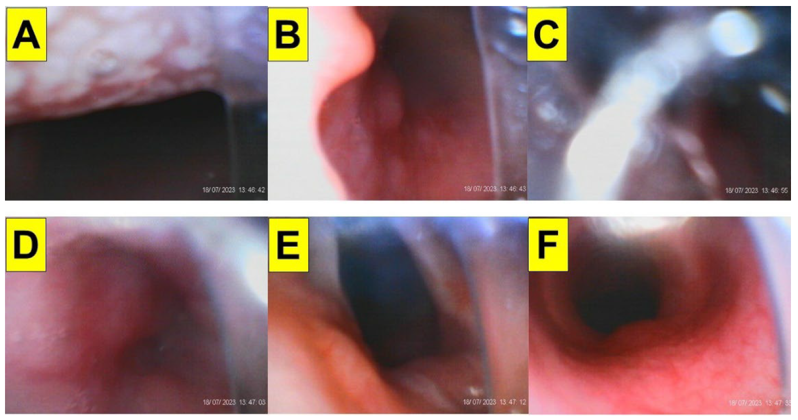 Surgeries 05 00015 g015 Surgeries 05 00015 g015