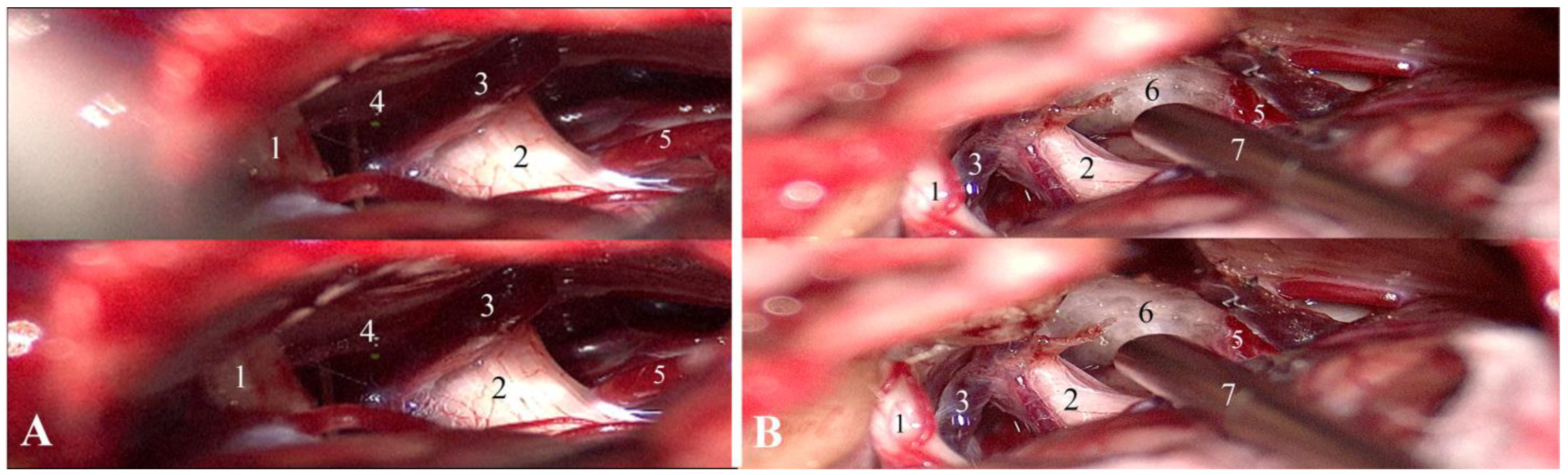 Surgeries 05 00017 g003