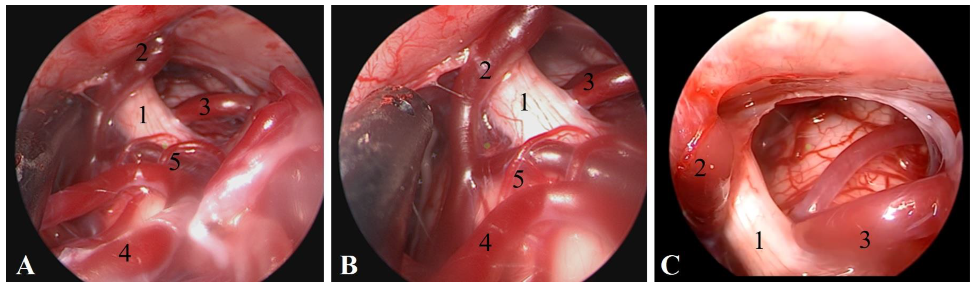 Surgeries 05 00017 g004