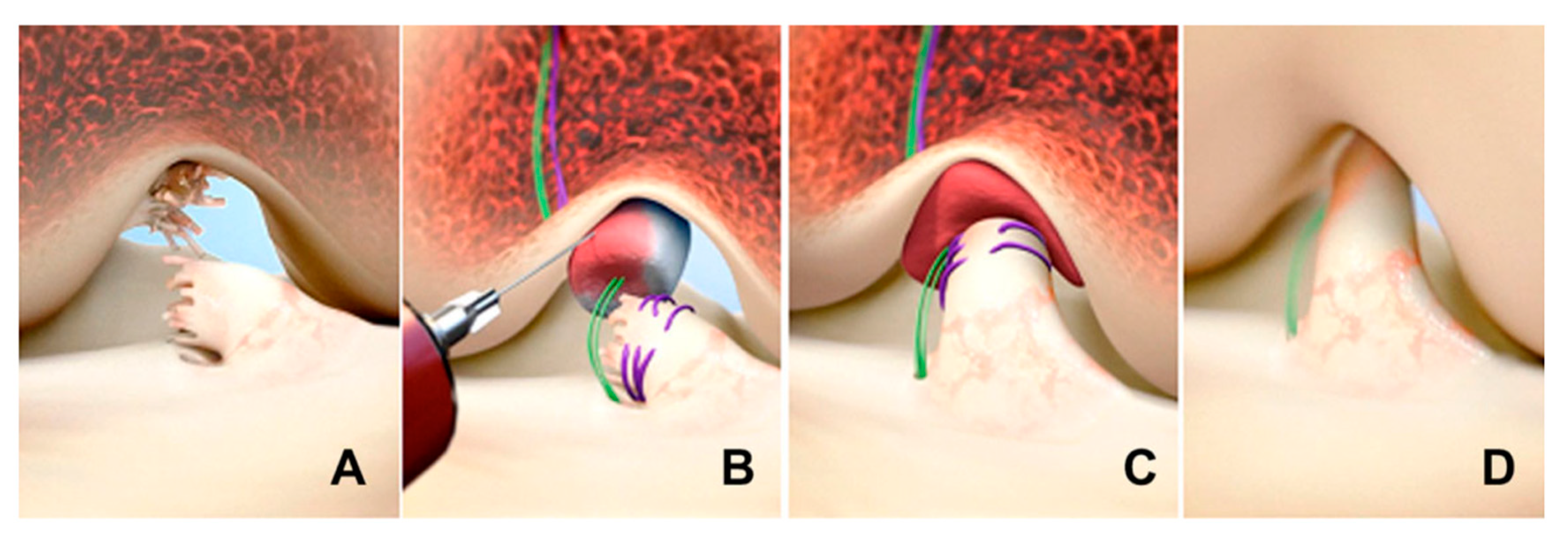 Surgeries 05 00022 g004
