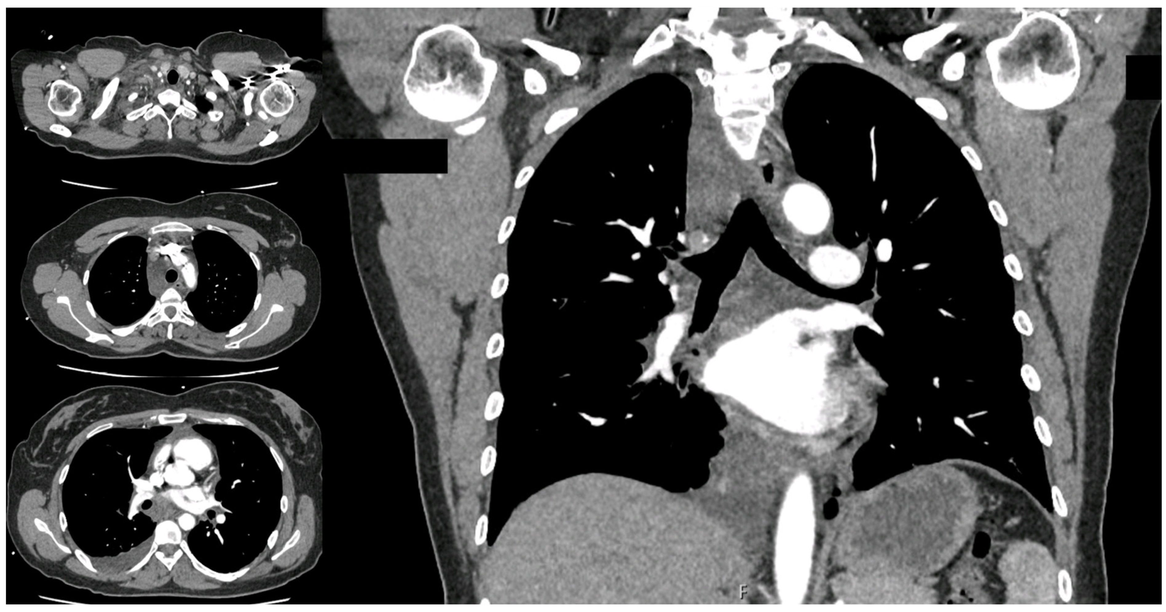Surgeries 05 00026 g001