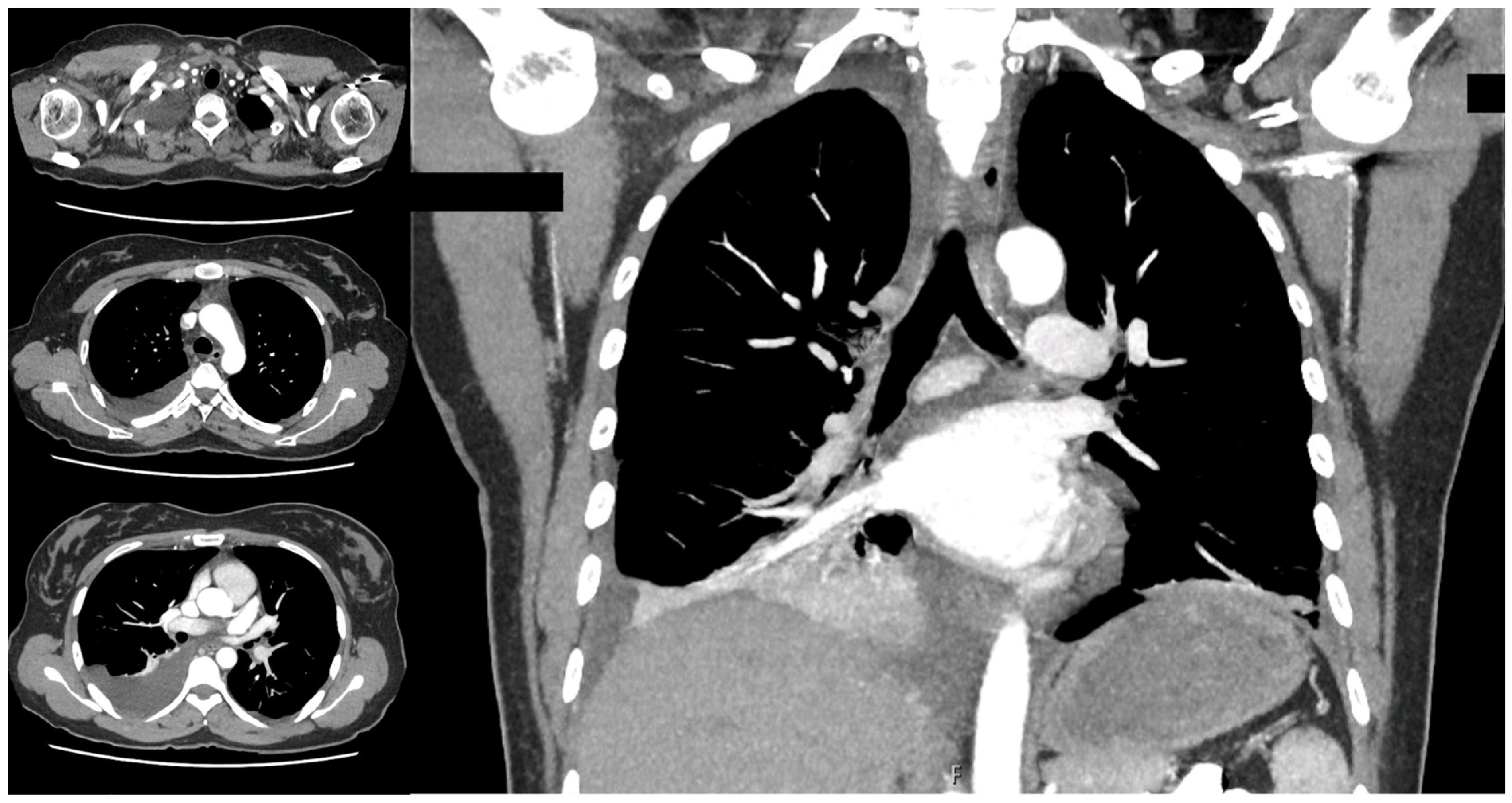 Surgeries 05 00026 g002