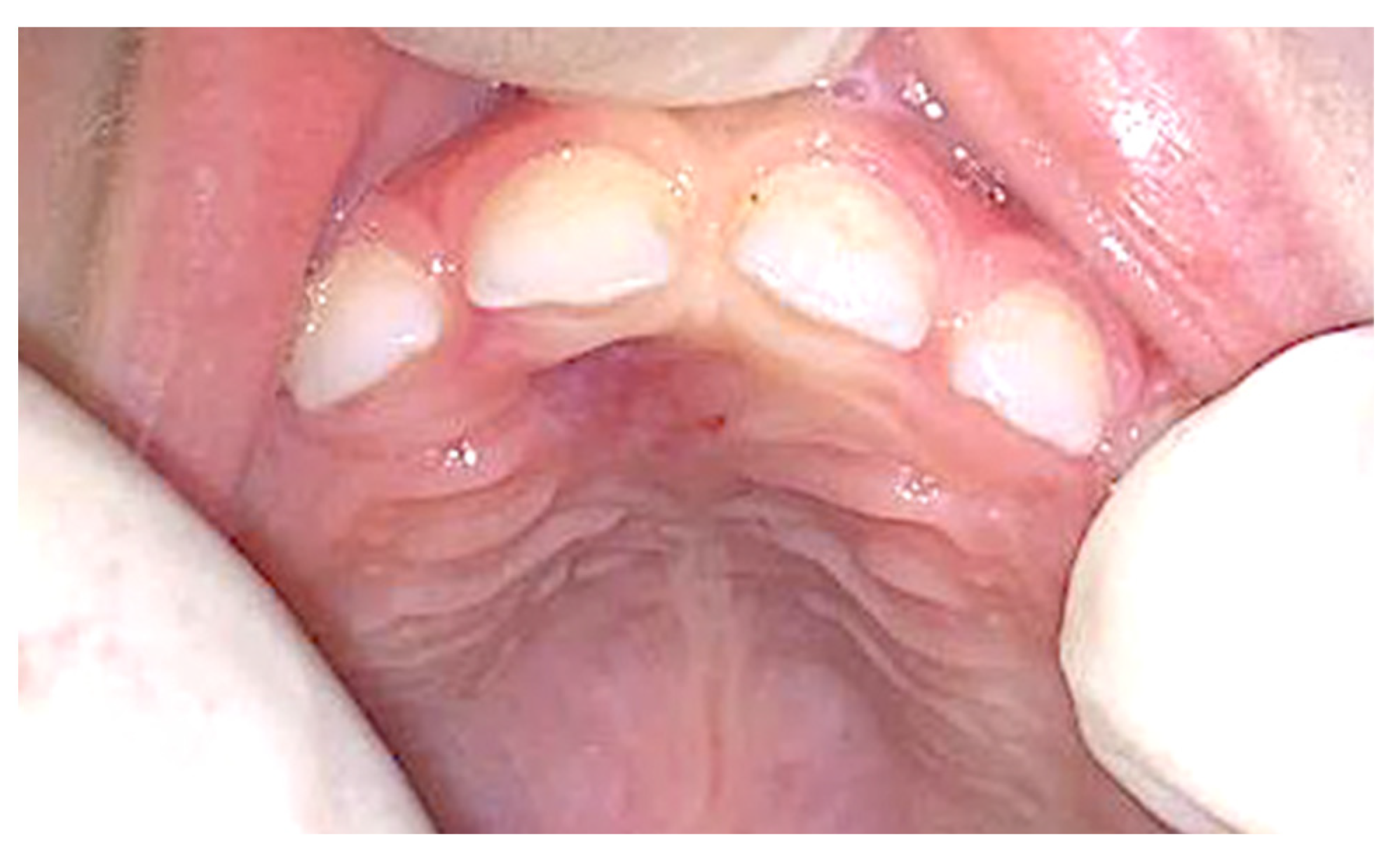 Surgeries 05 00032 g004