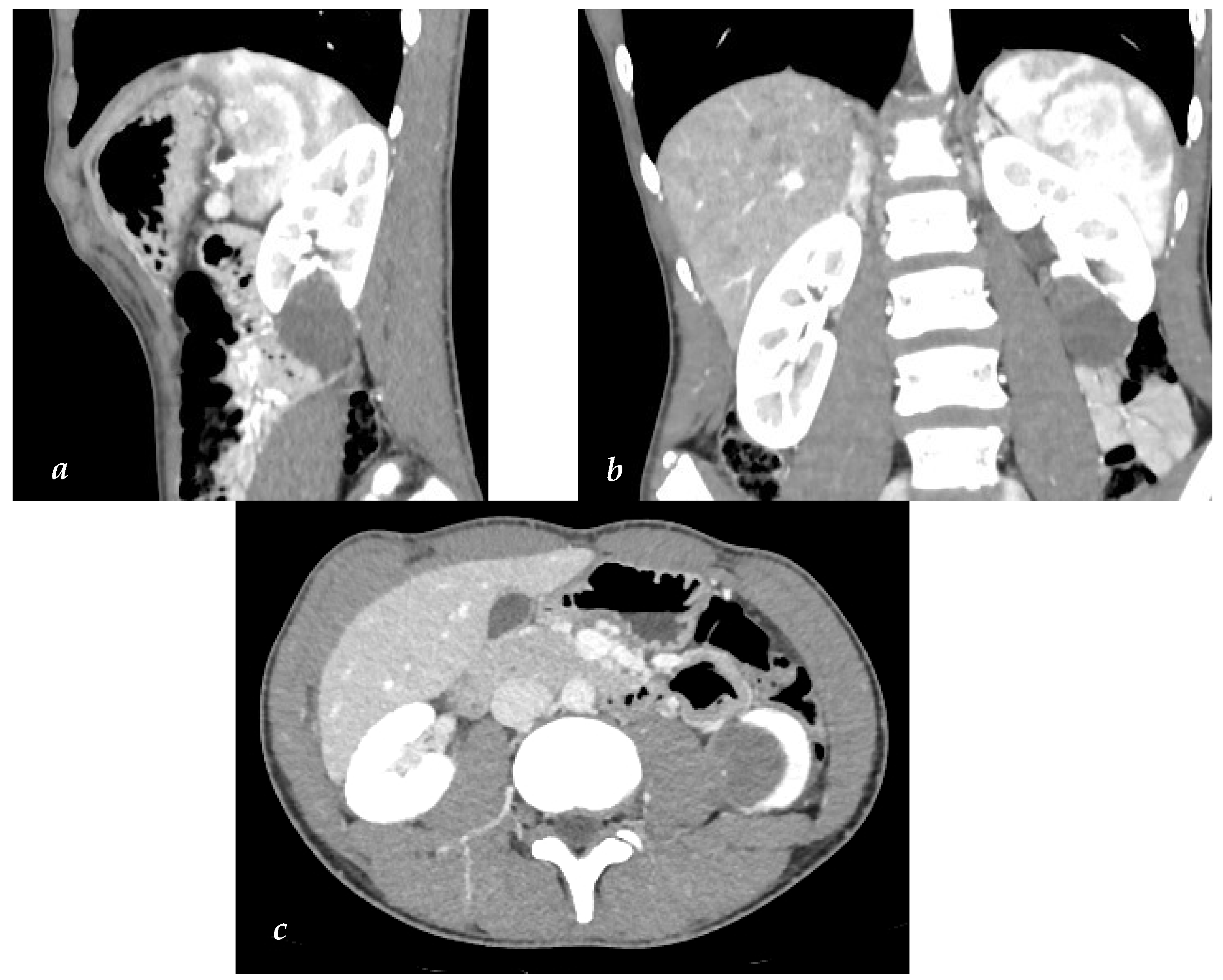 Surgeries 05 00034 g001