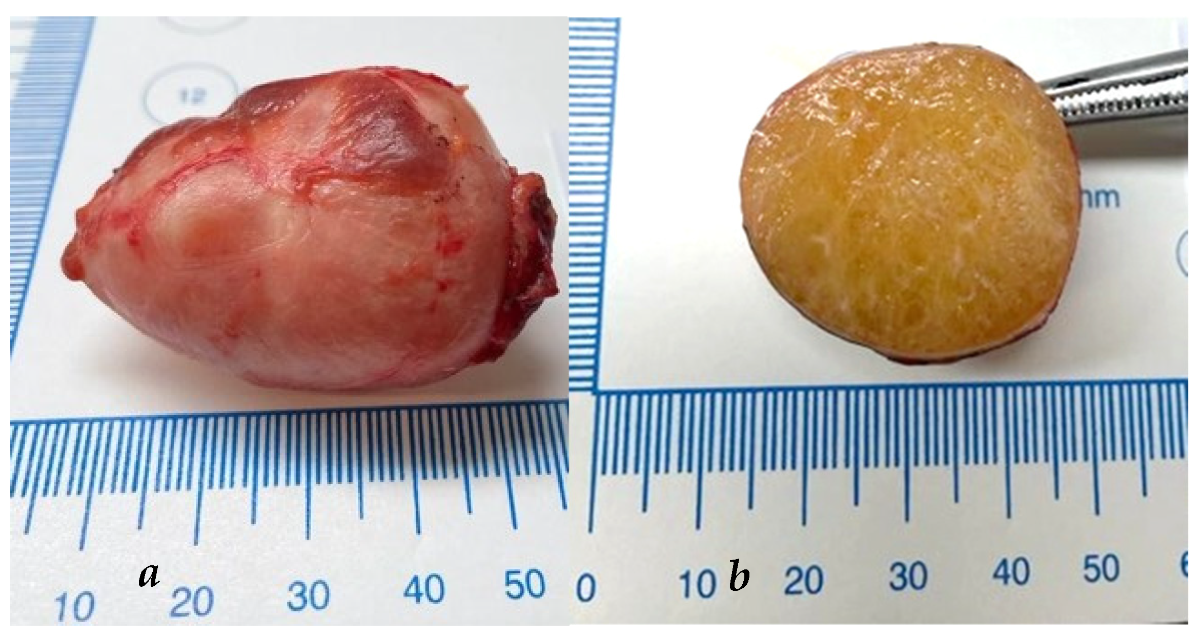 Surgeries 05 00034 g005