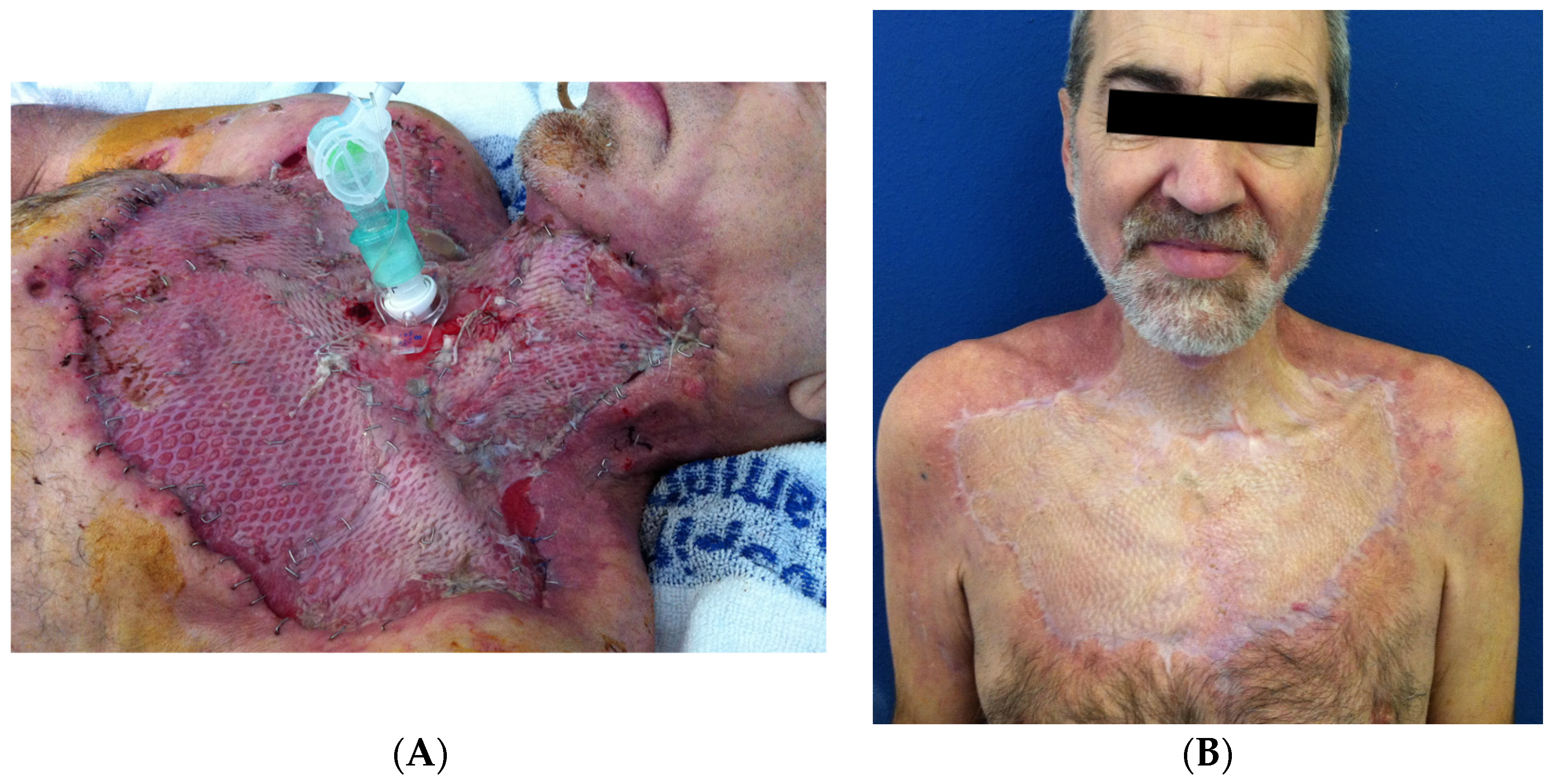 Surgeries 05 00042 g005