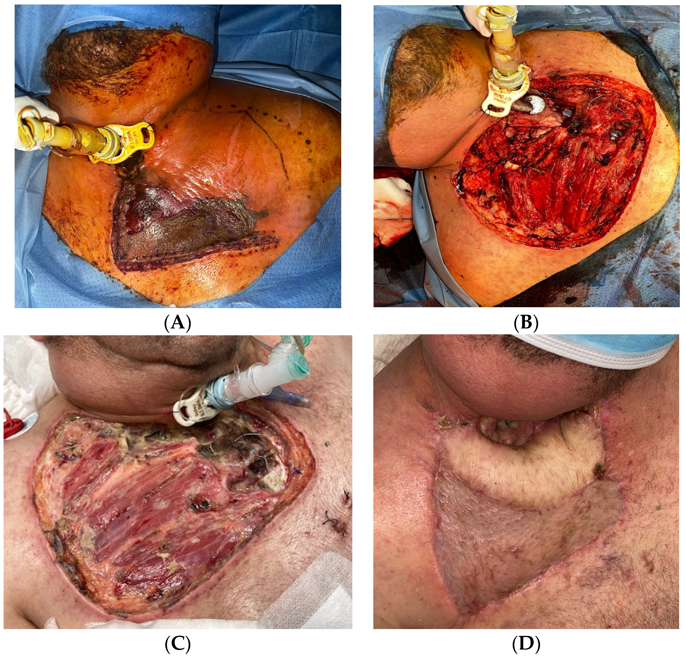 Surgeries 05 00042 g006