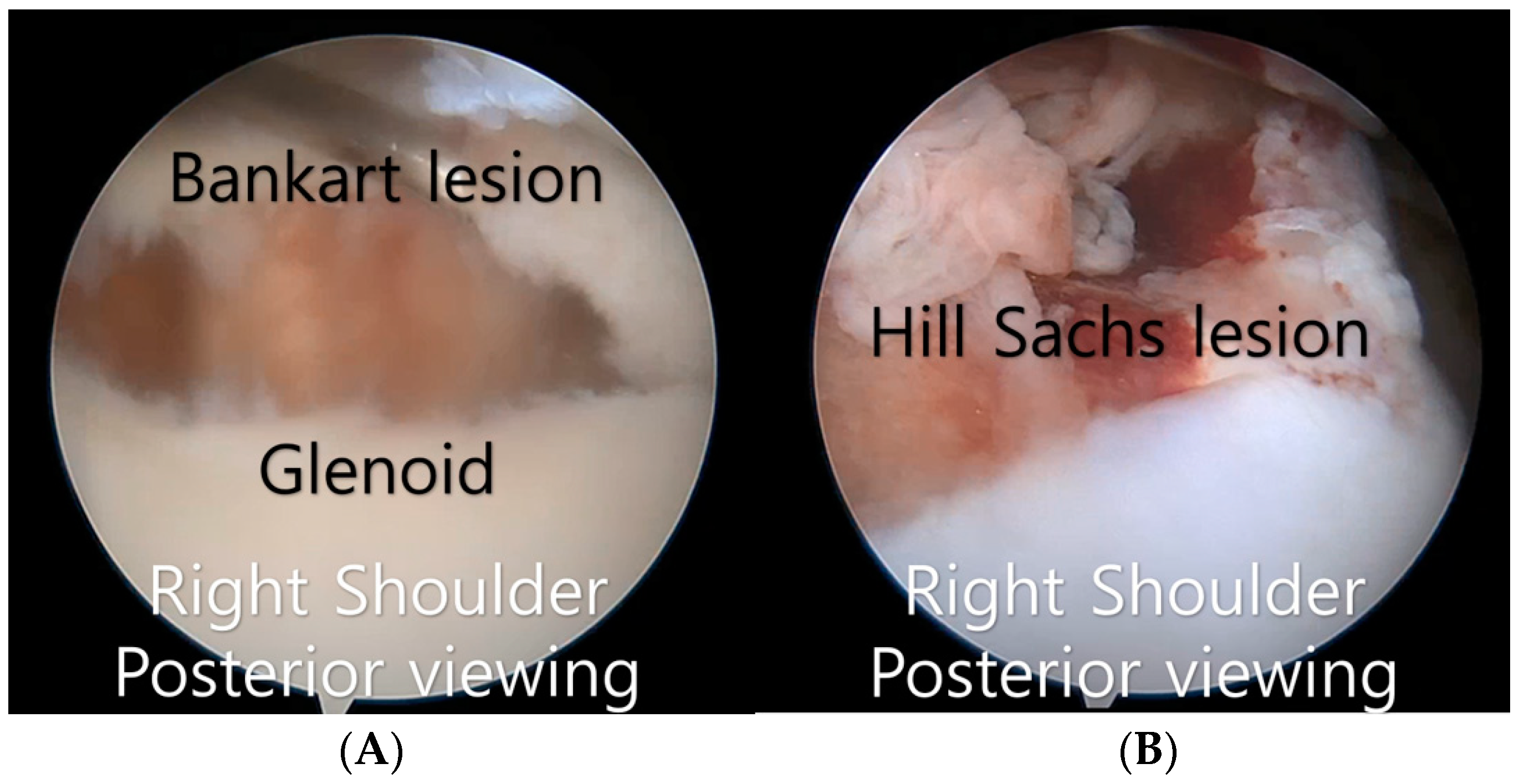Surgeries 05 00046 g002