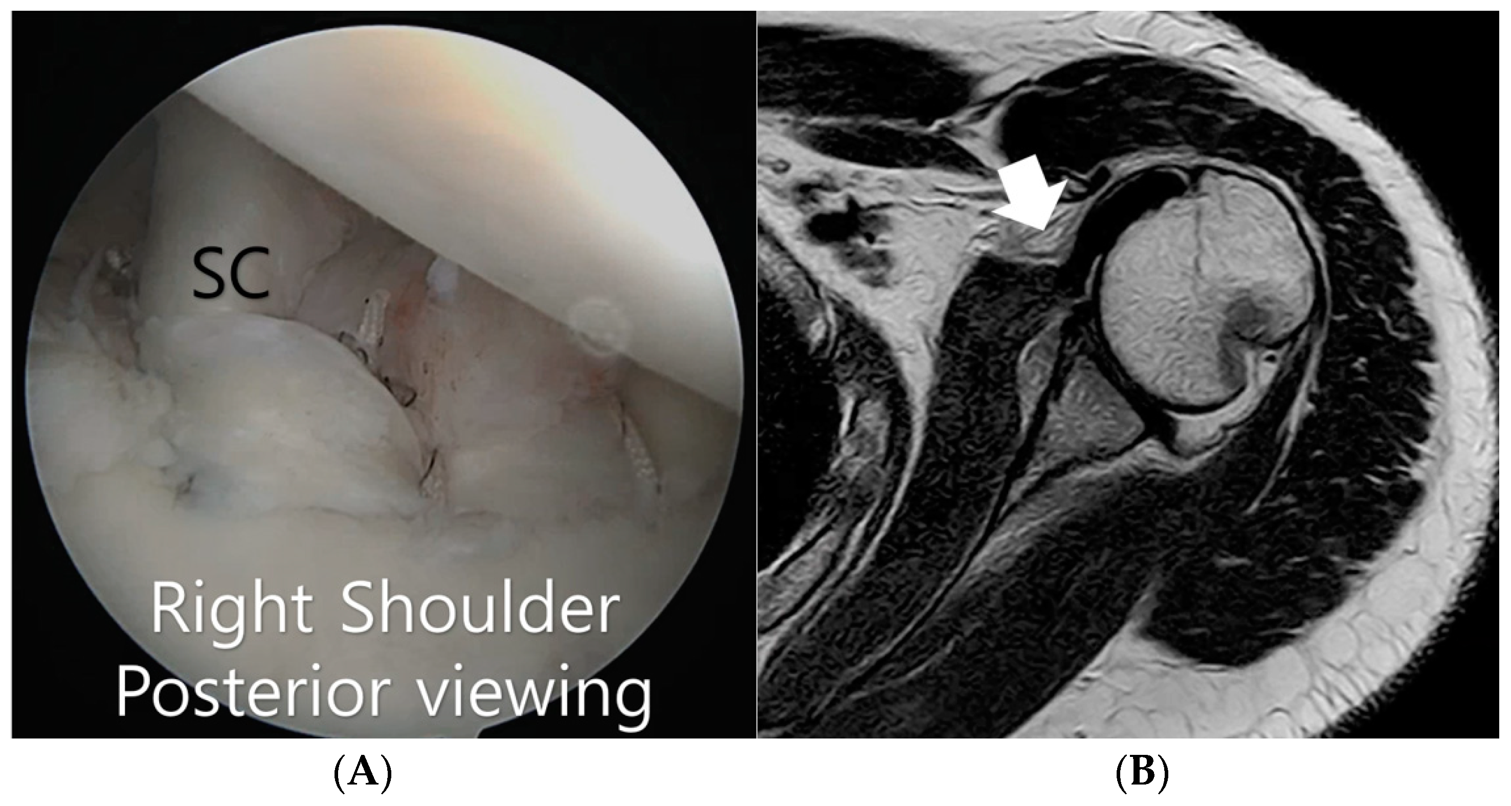 Surgeries 05 00046 g003