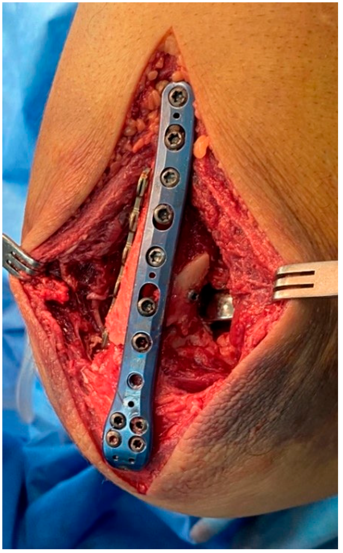 Surgeries 05 00048 g005