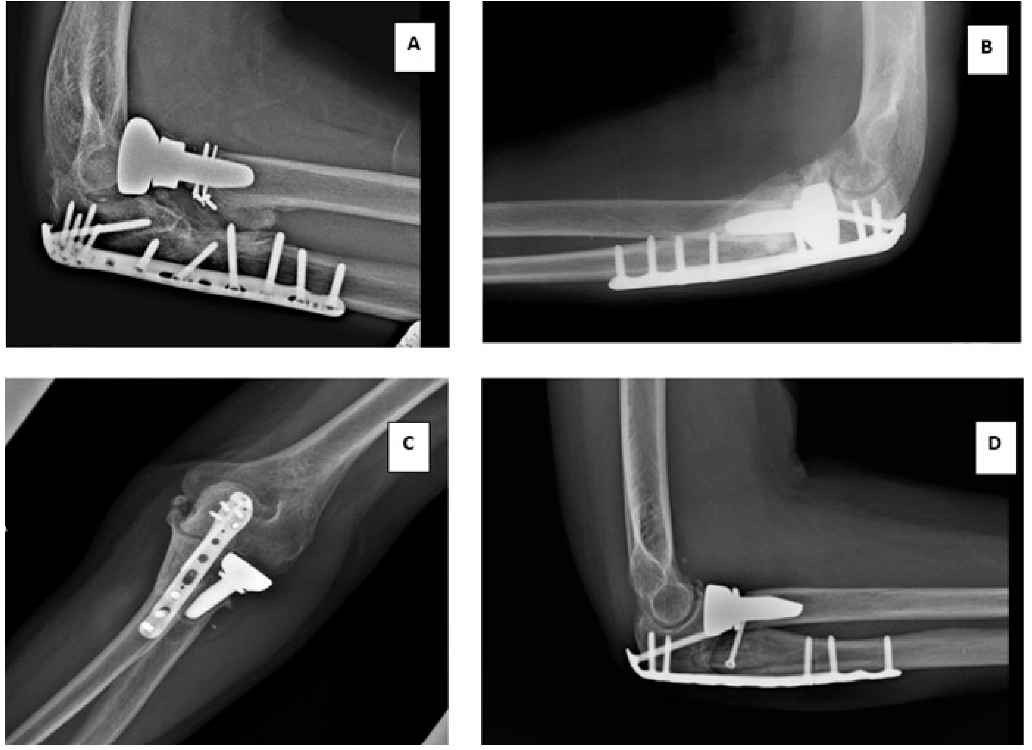 Surgeries 05 00048 g006
