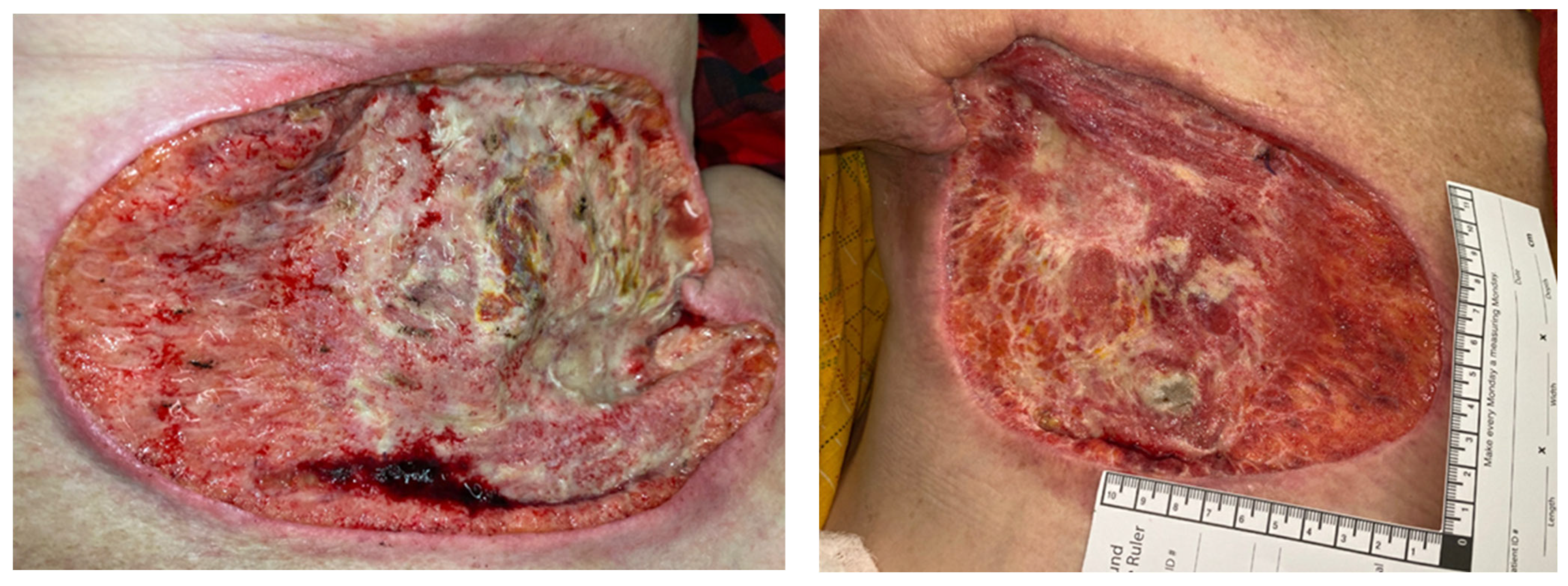 Surgeries 05 00060 g003