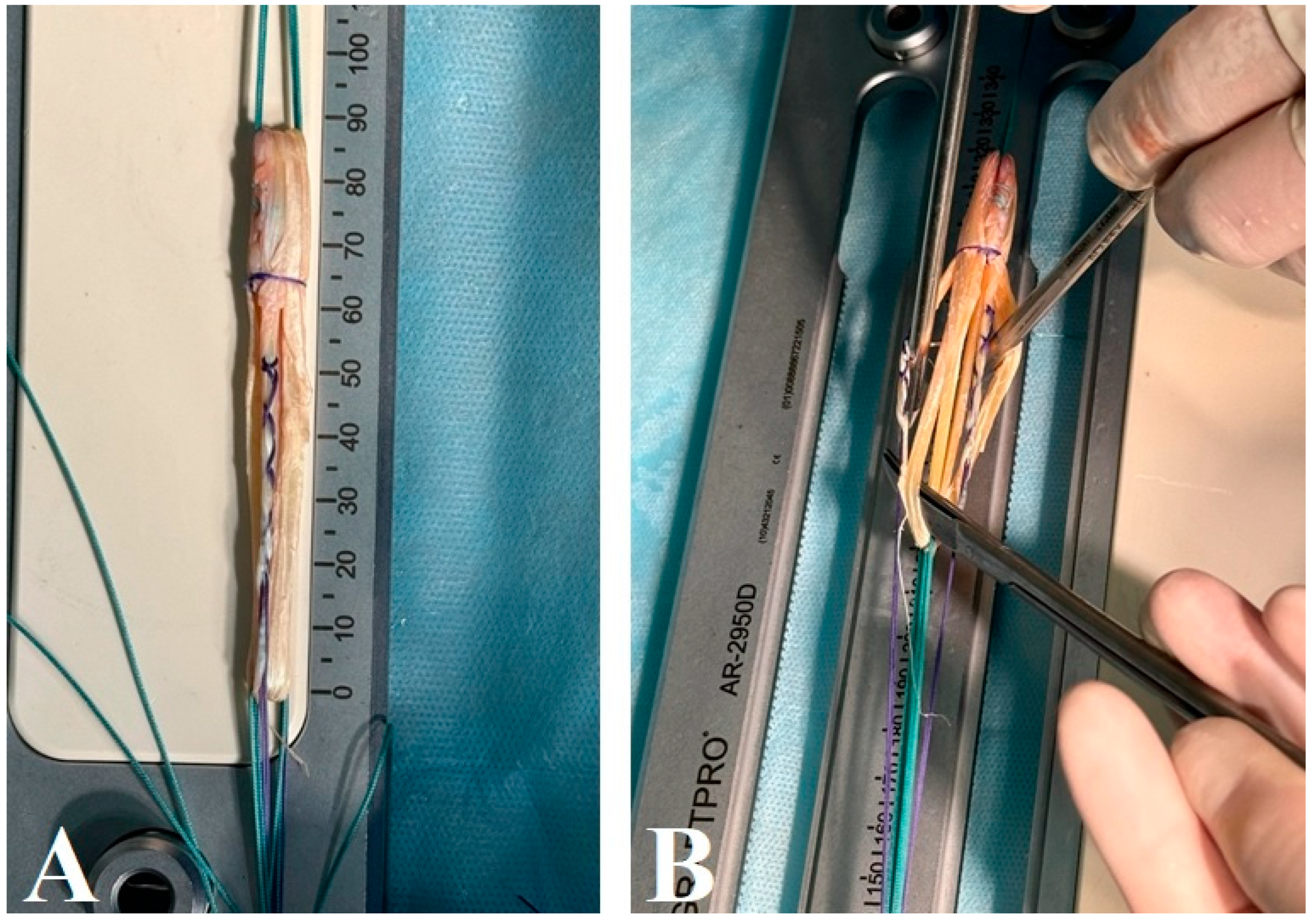 Surgeries 05 00063 g002
