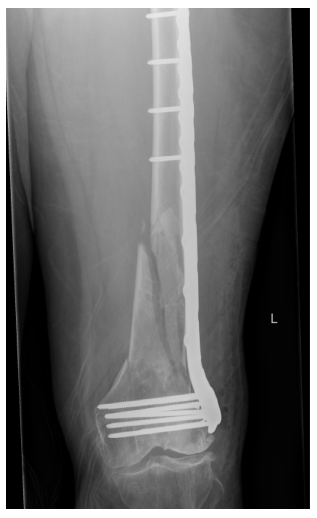 Surgeries 05 00064 g004