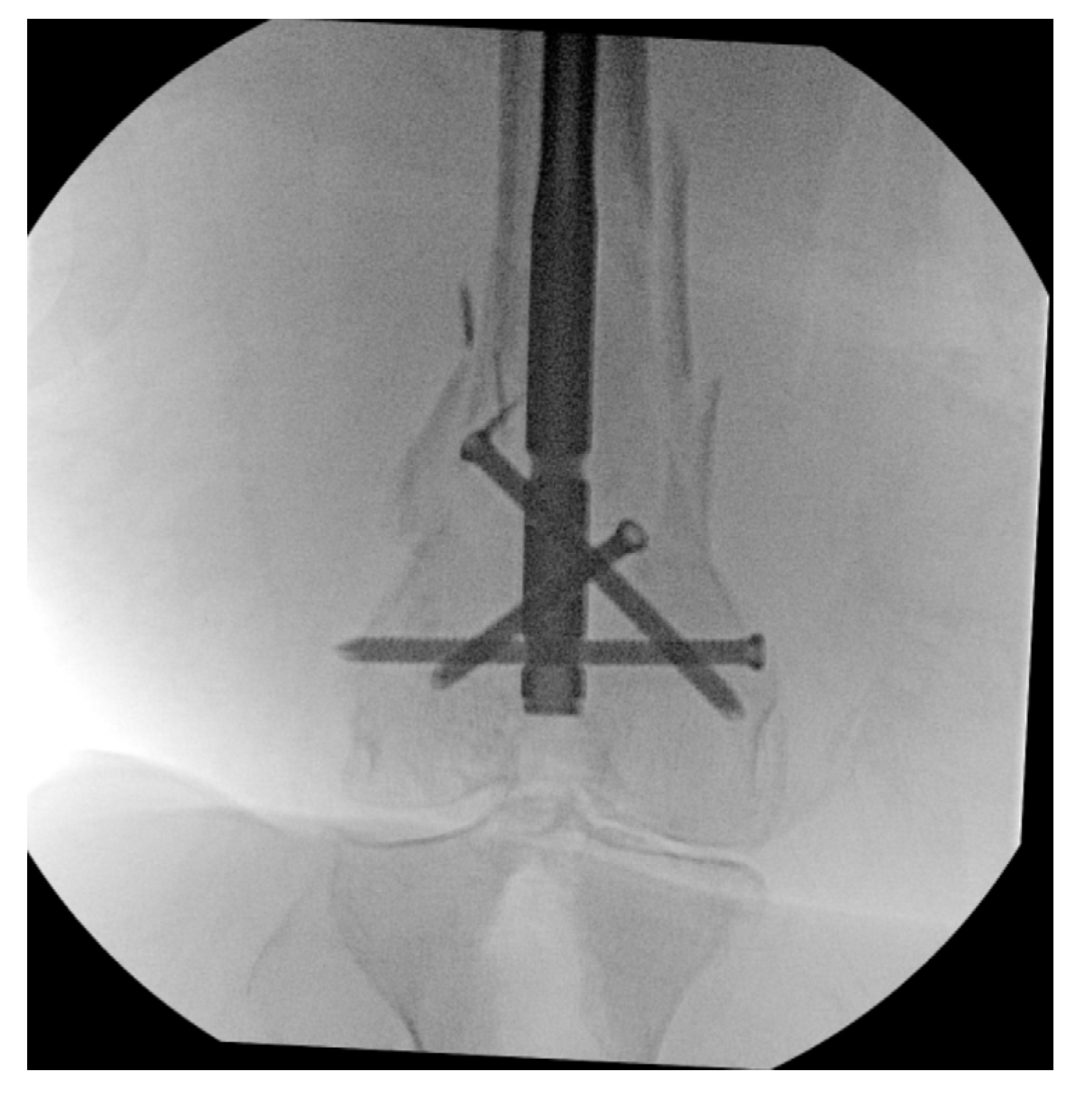 Surgeries 05 00064 g005