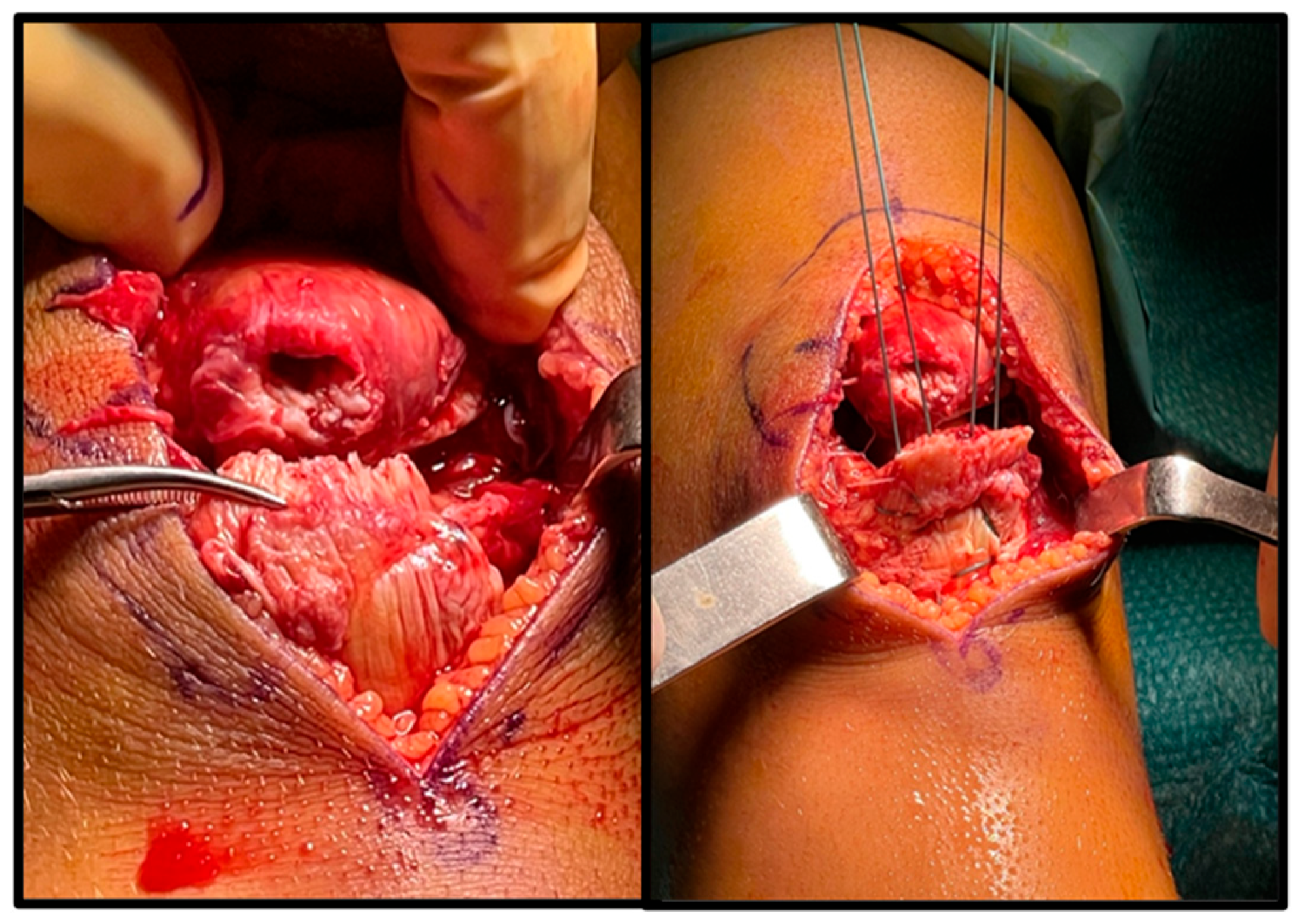 Surgeries 05 00067 g002