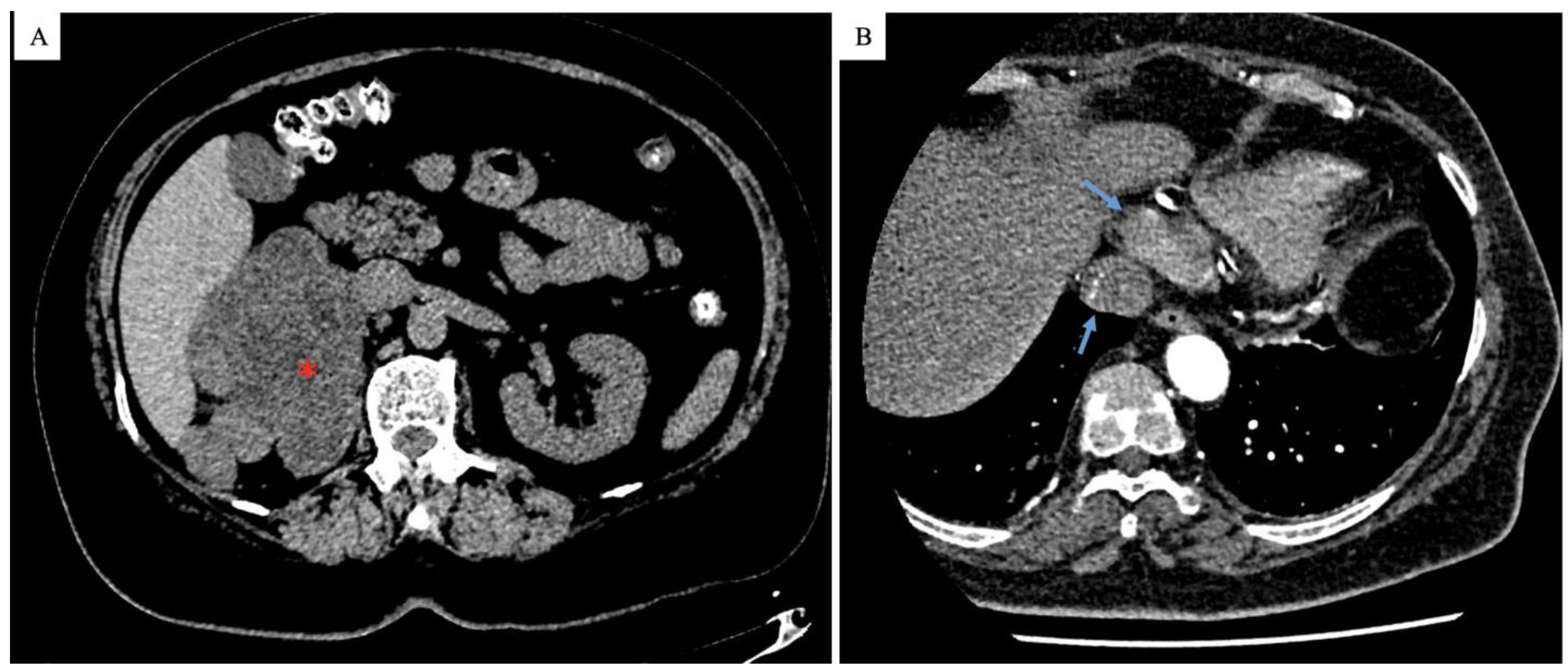 Surgeries 05 00087 g001