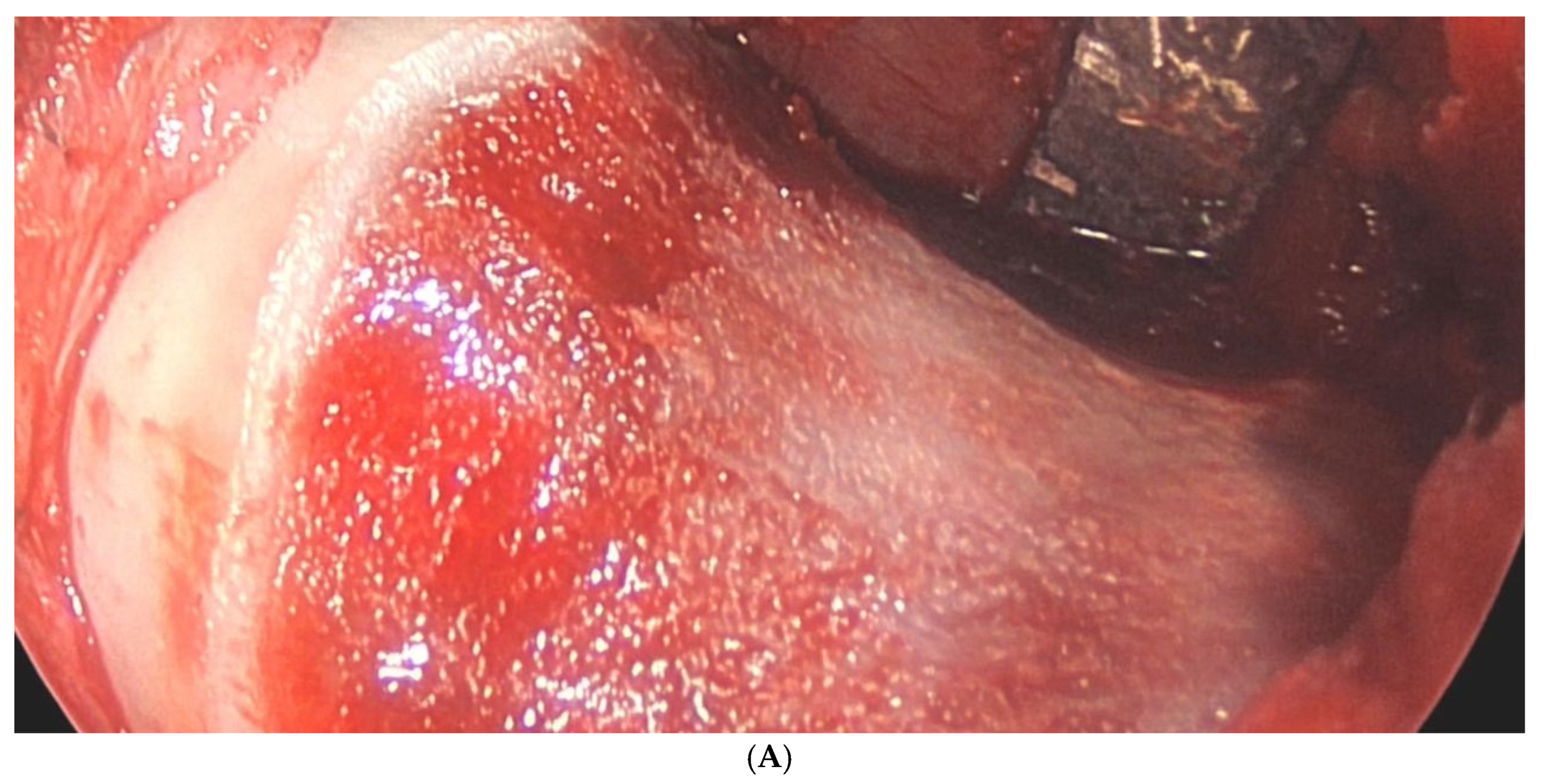 Surgeries 05 00089 g004a