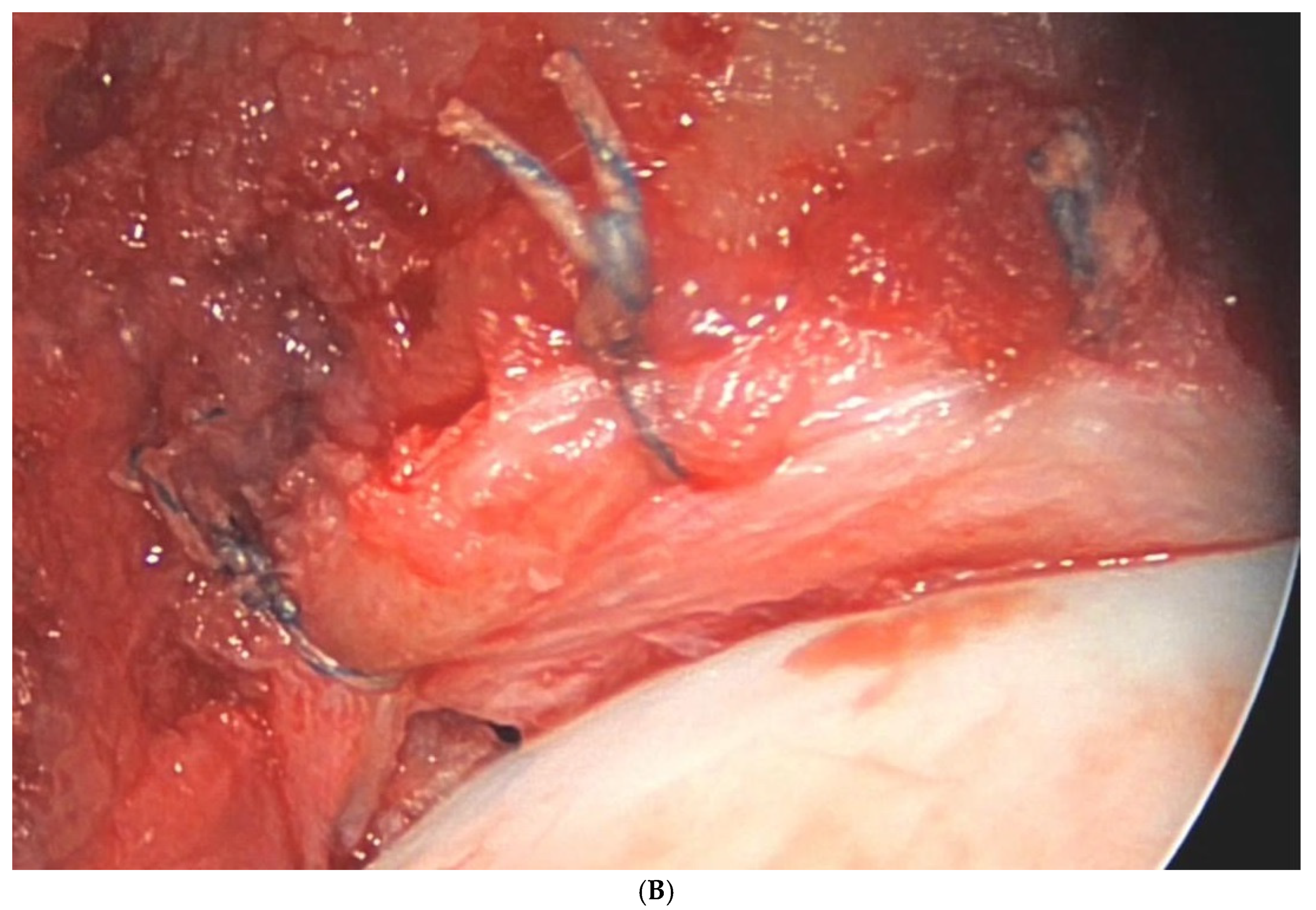 Surgeries 05 00089 g004b