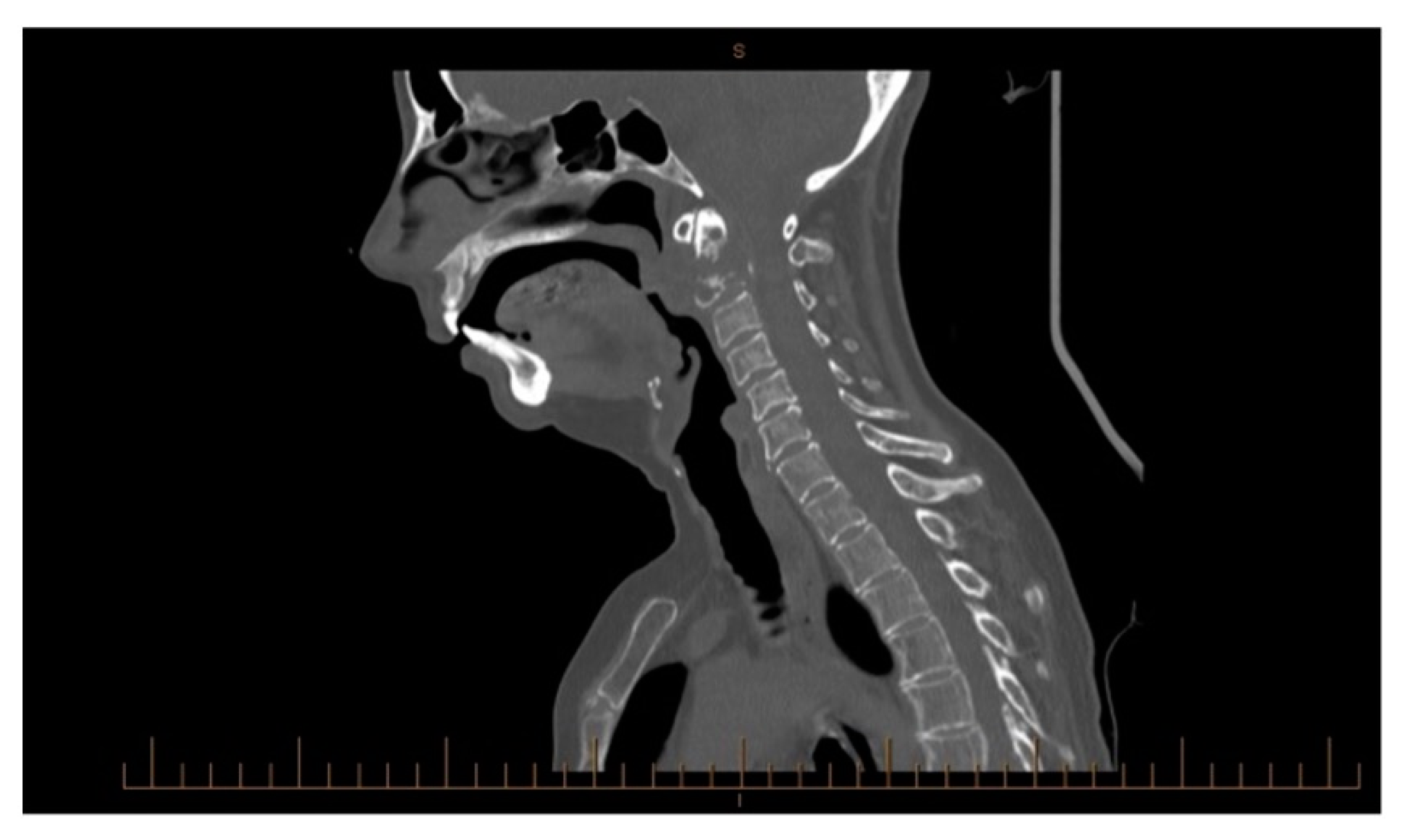 Surgeries 05 00091 g002
