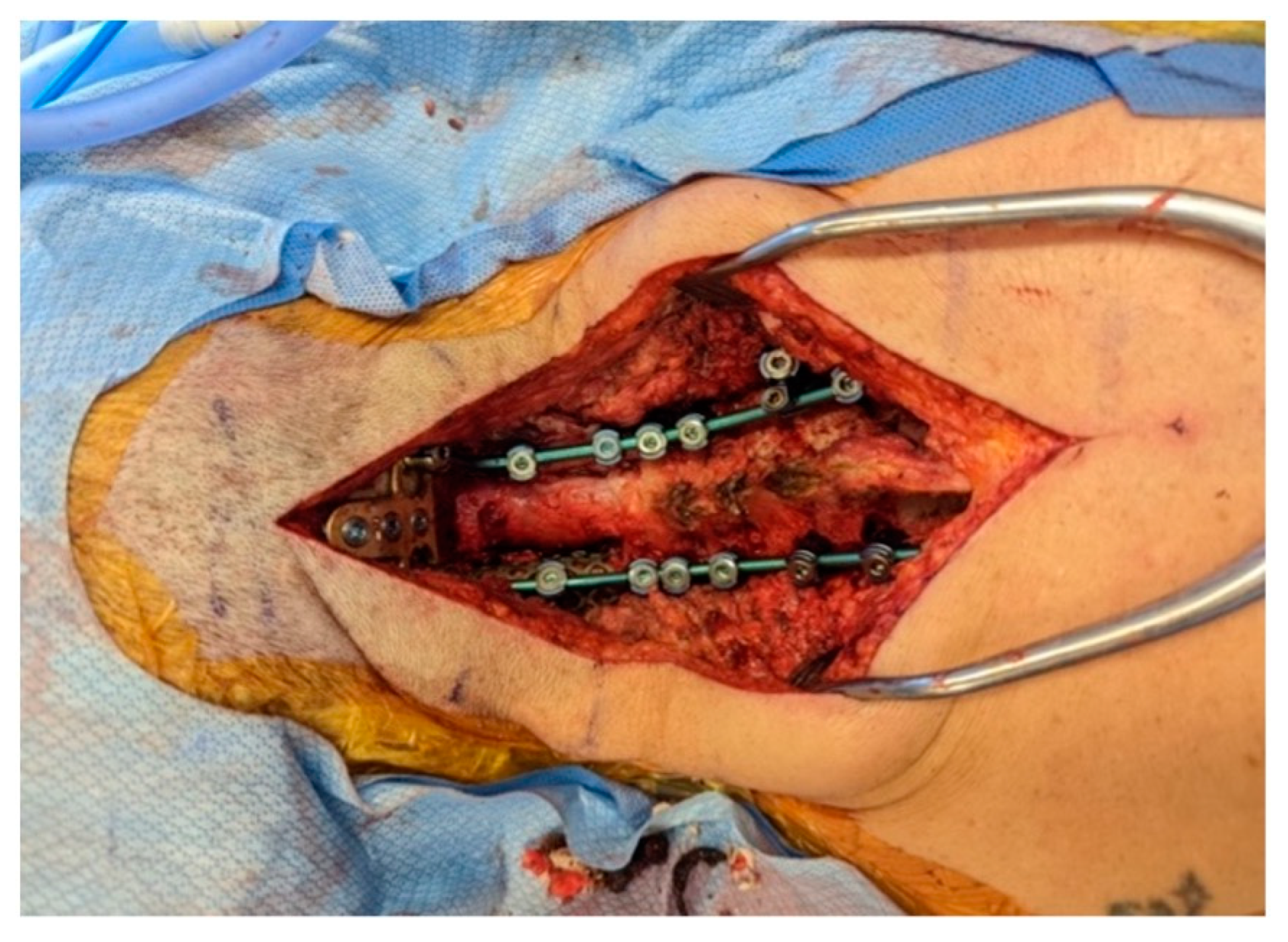 Surgeries 05 00091 g004