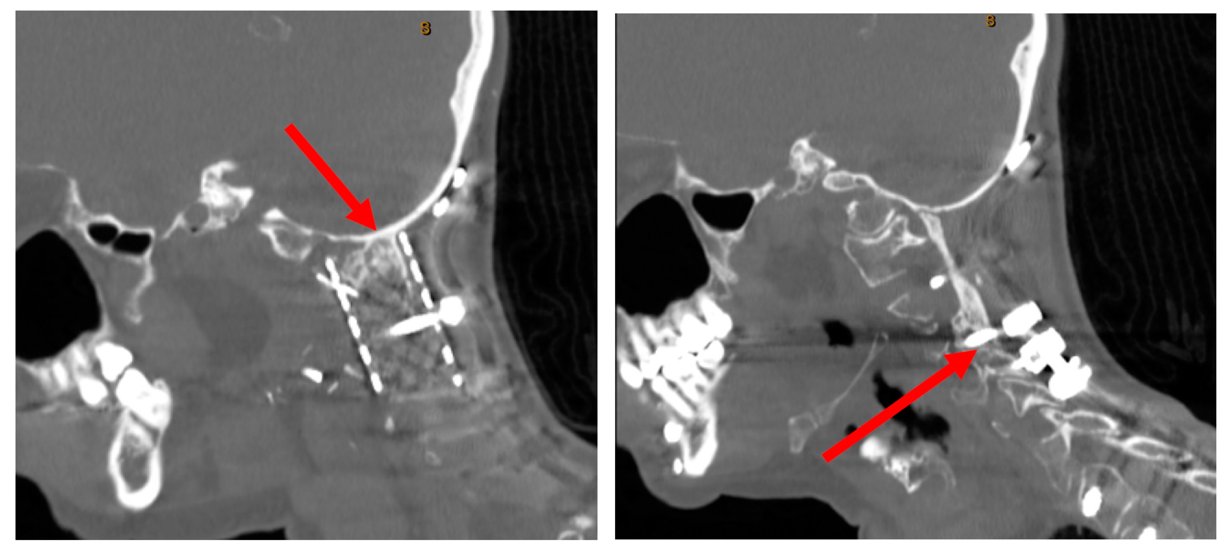 Surgeries 05 00091 g005