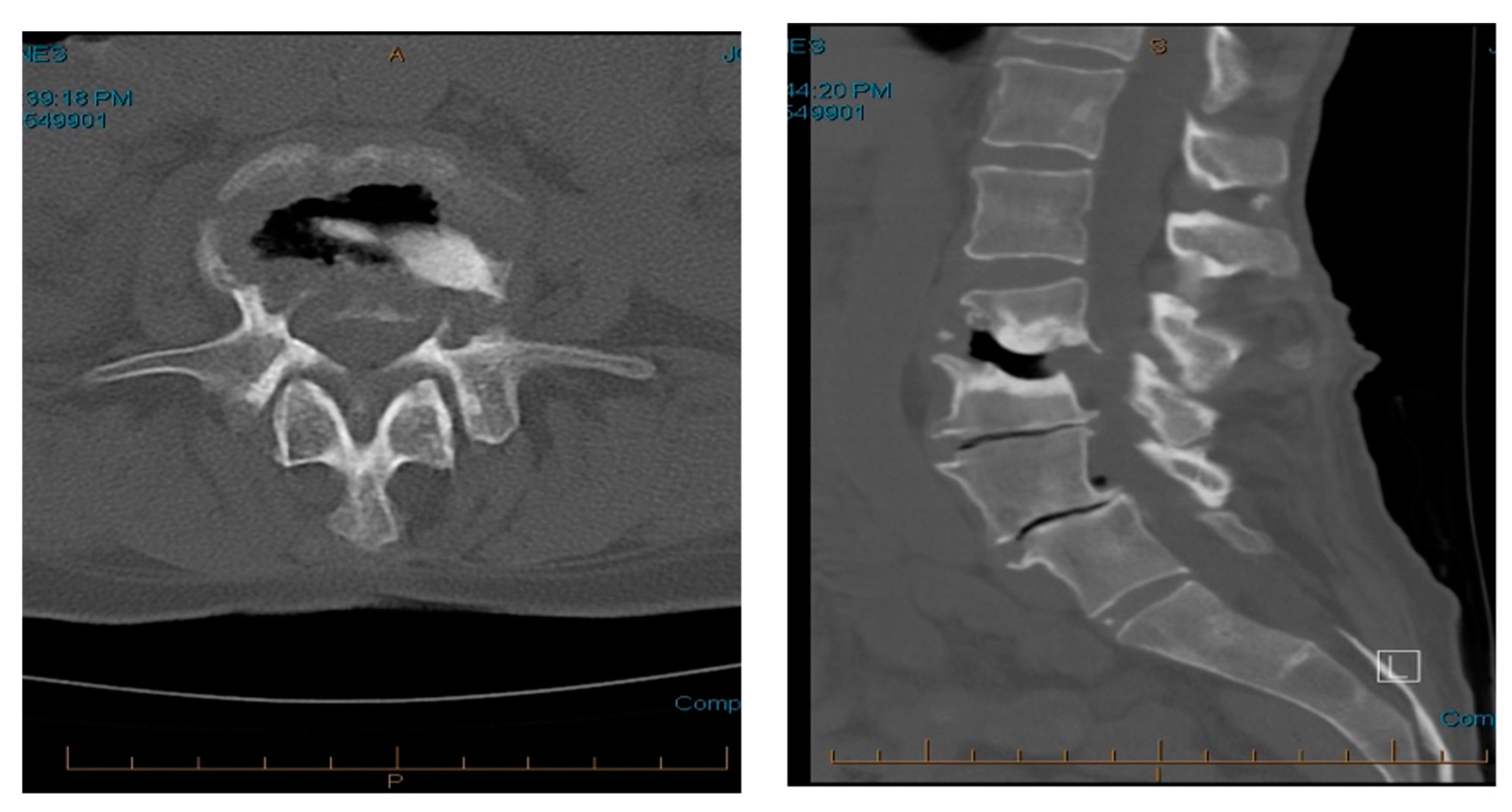 Surgeries 05 00091 g006