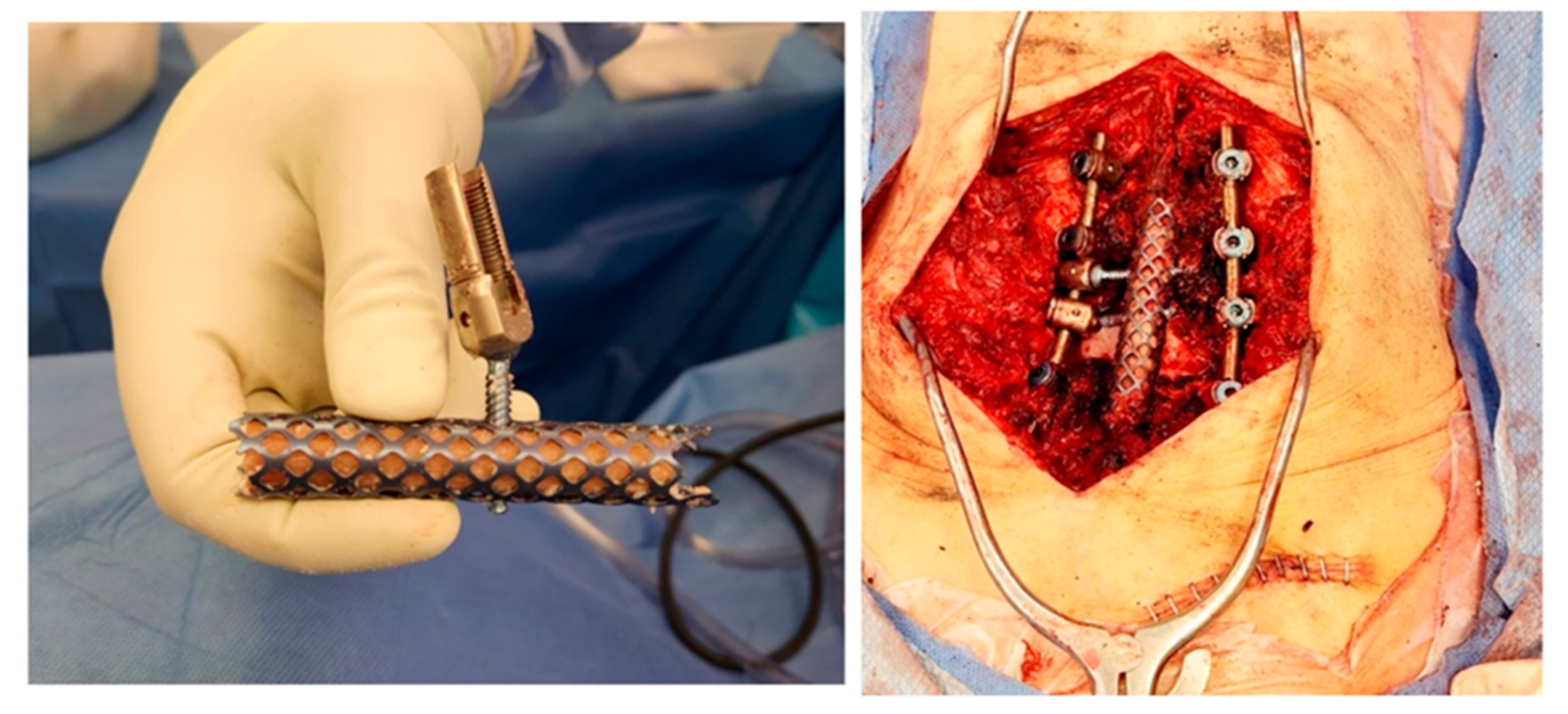 Surgeries 05 00091 g008