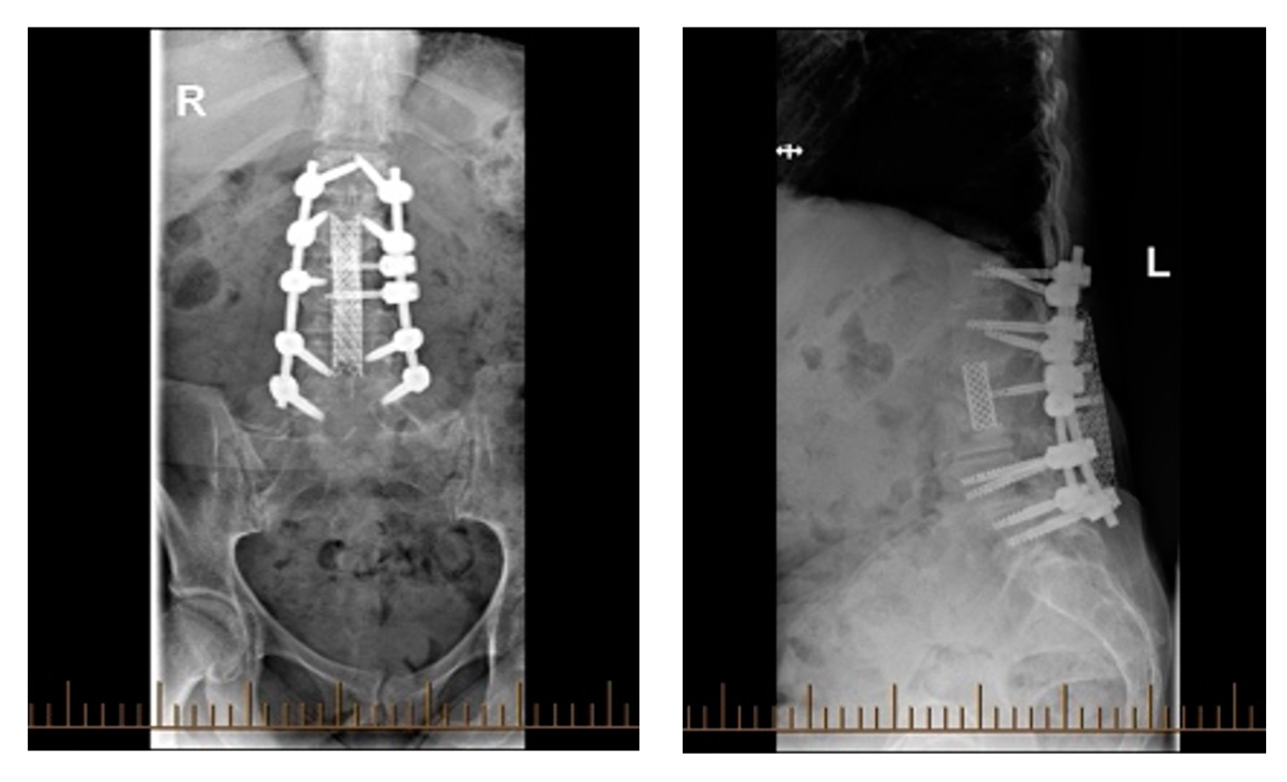Surgeries 05 00091 g009