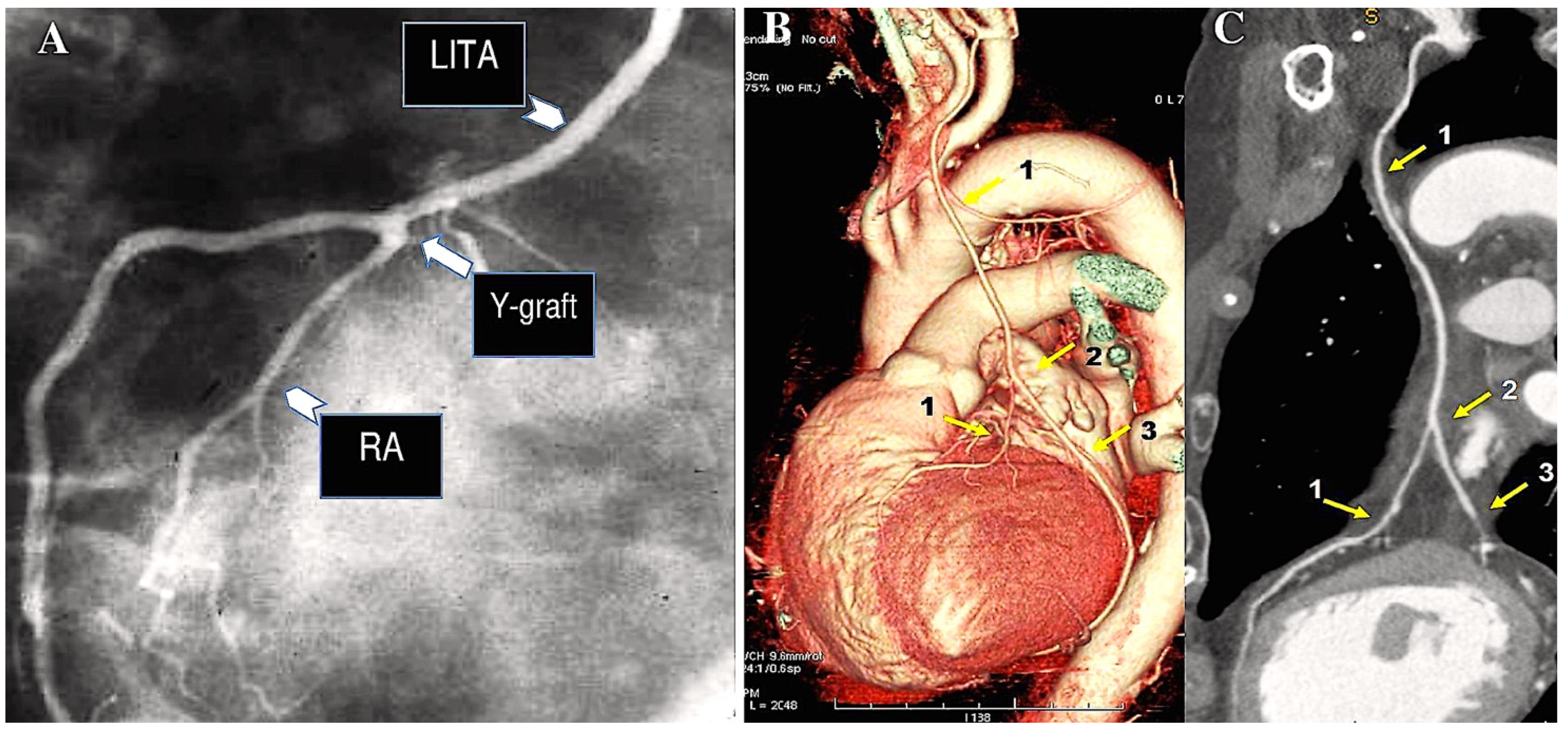 Surgeries 06 00006 g004 Surgeries 06 00006 g004