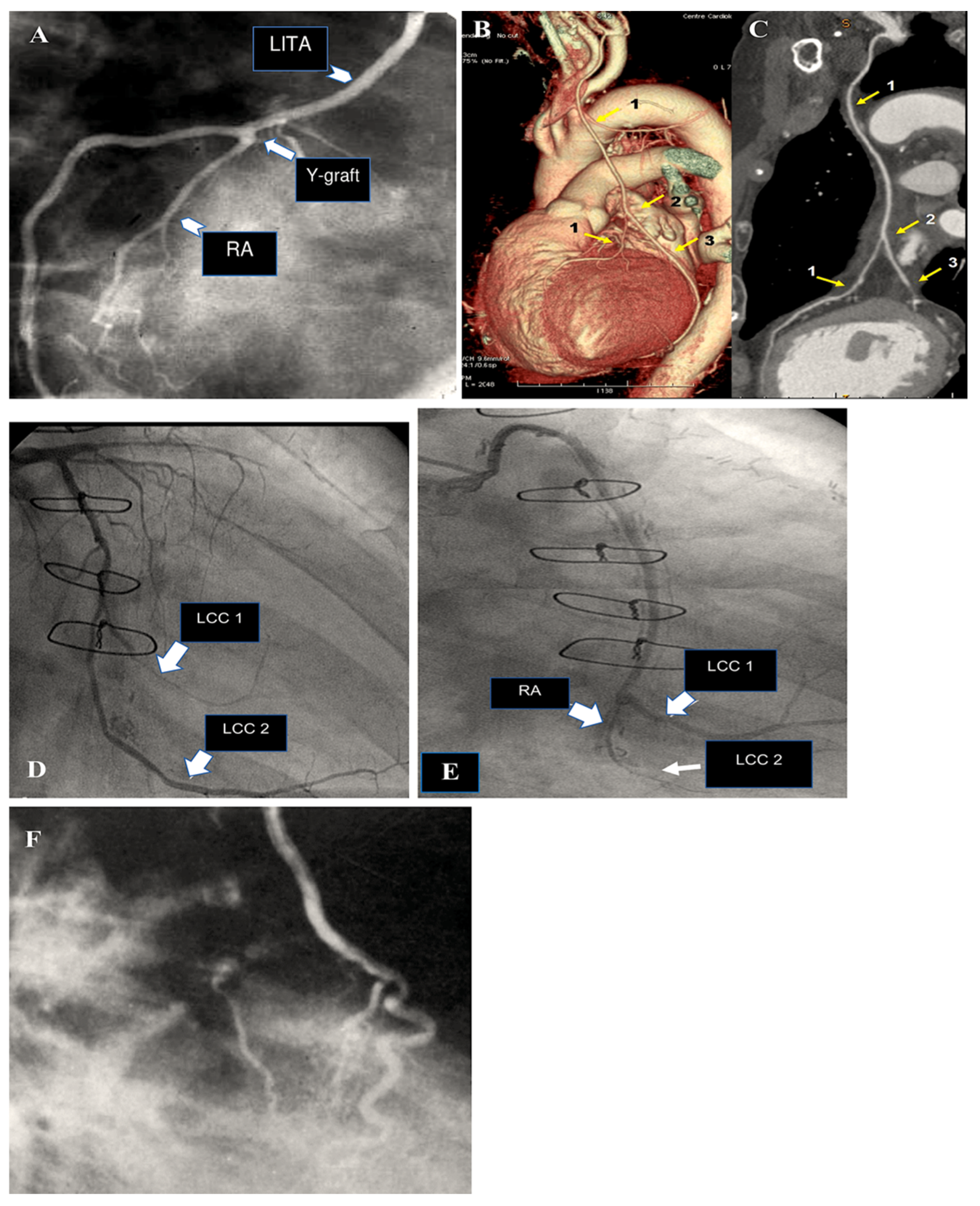 Surgeries 06 00006 g005 Surgeries 06 00006 g005