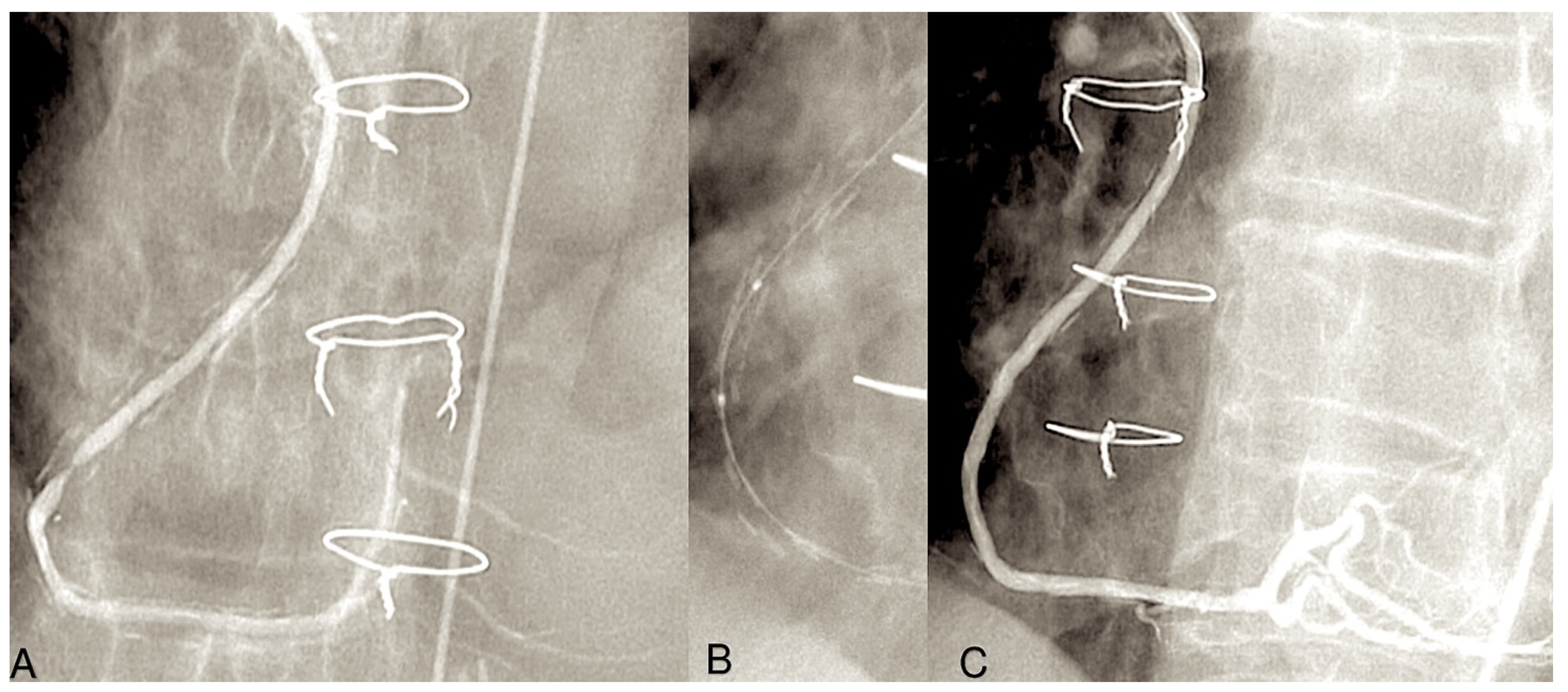 Surgeries 06 00006 g006 Surgeries 06 00006 g006