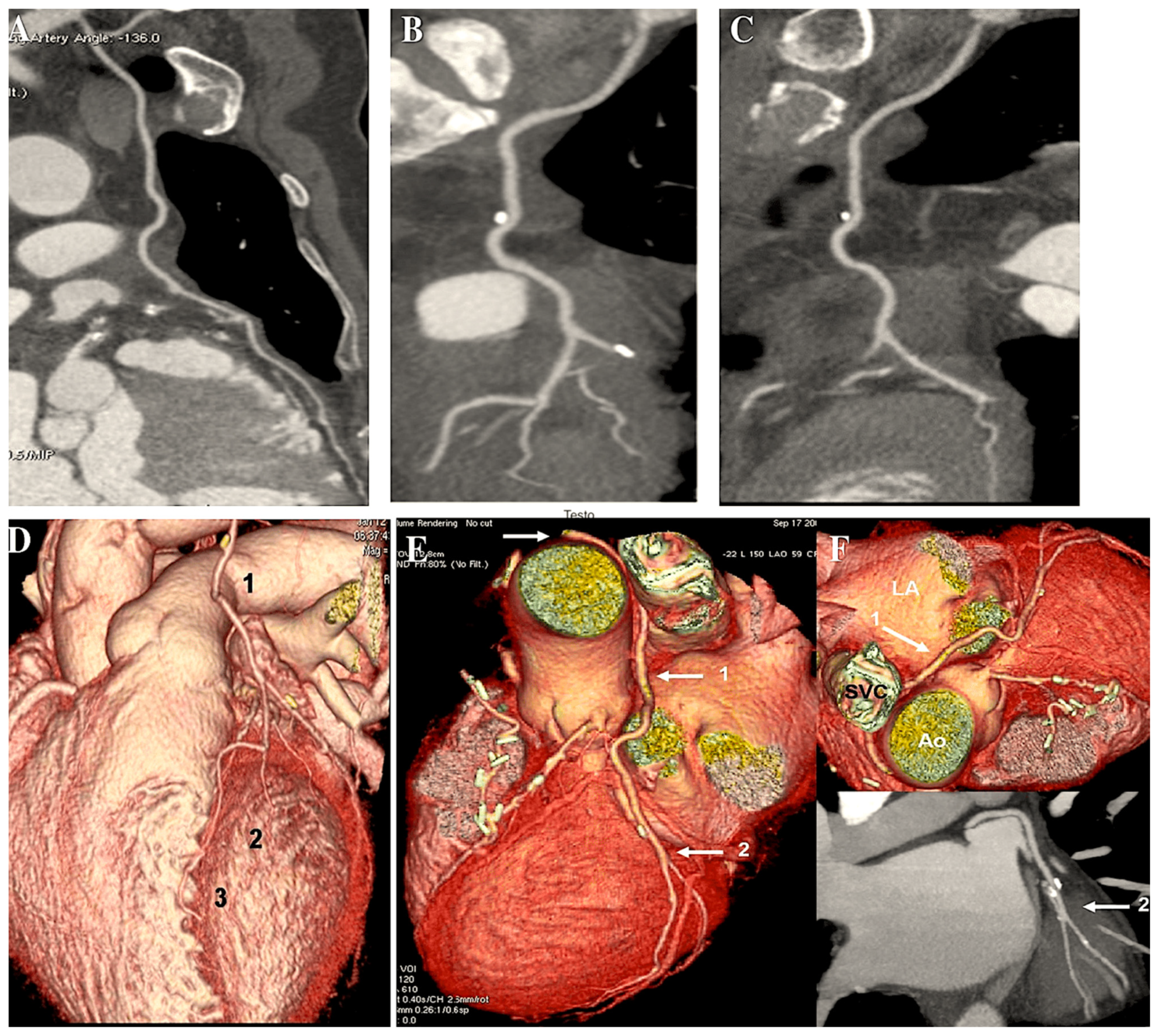 Surgeries 06 00006 g007 Surgeries 06 00006 g007